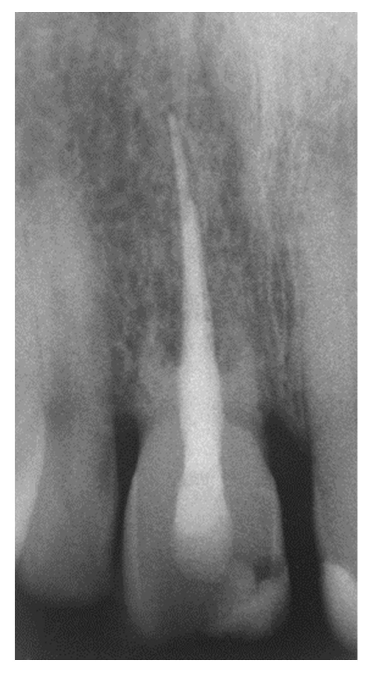 Dentistry 07 00101 g008 Dentistry 07 00101 g008