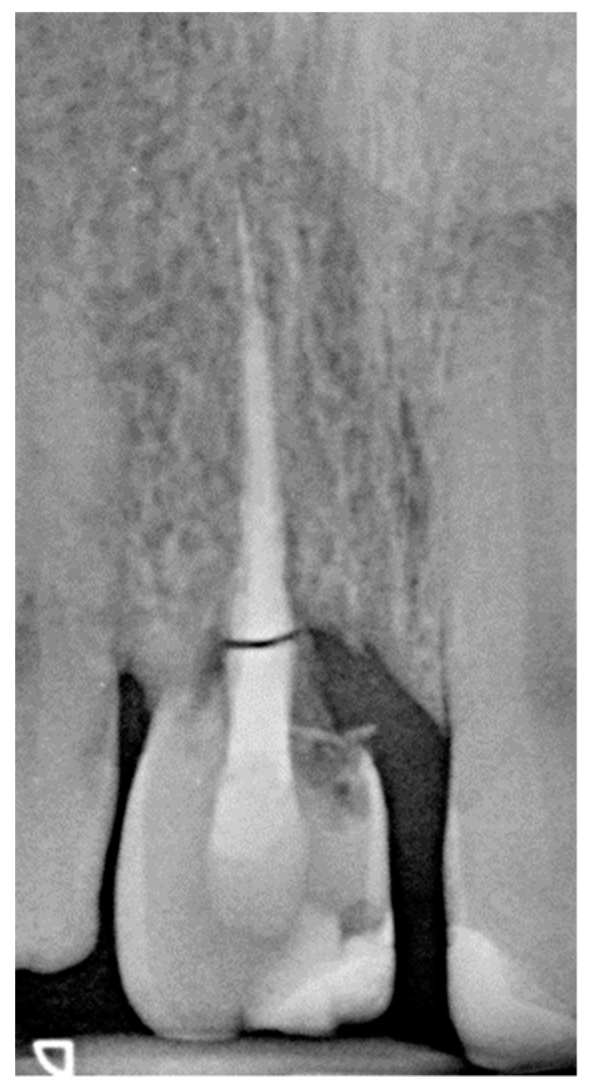 Dentistry 07 00101 g010 Dentistry 07 00101 g010