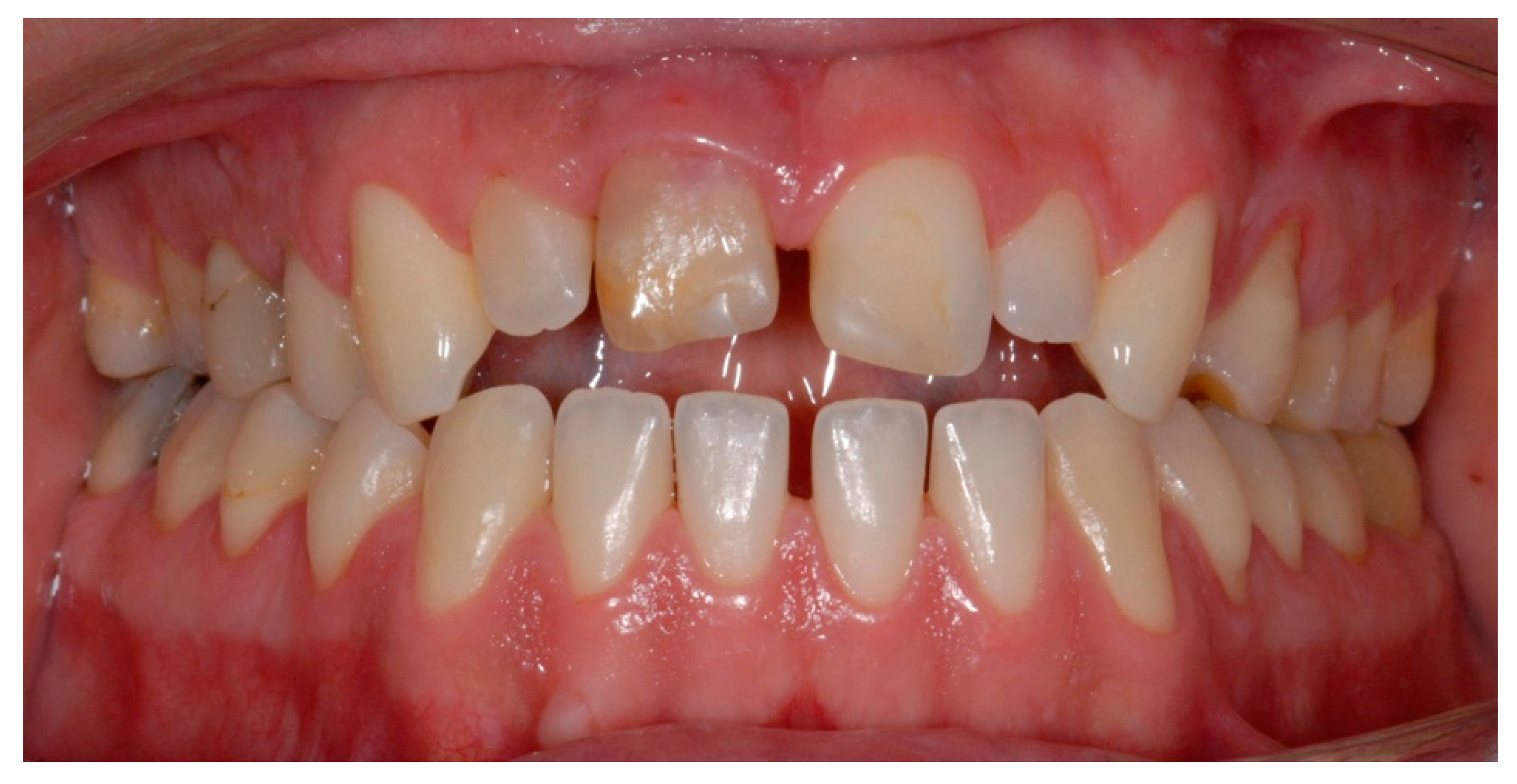 Dentistry 07 00101 g011 Dentistry 07 00101 g011
