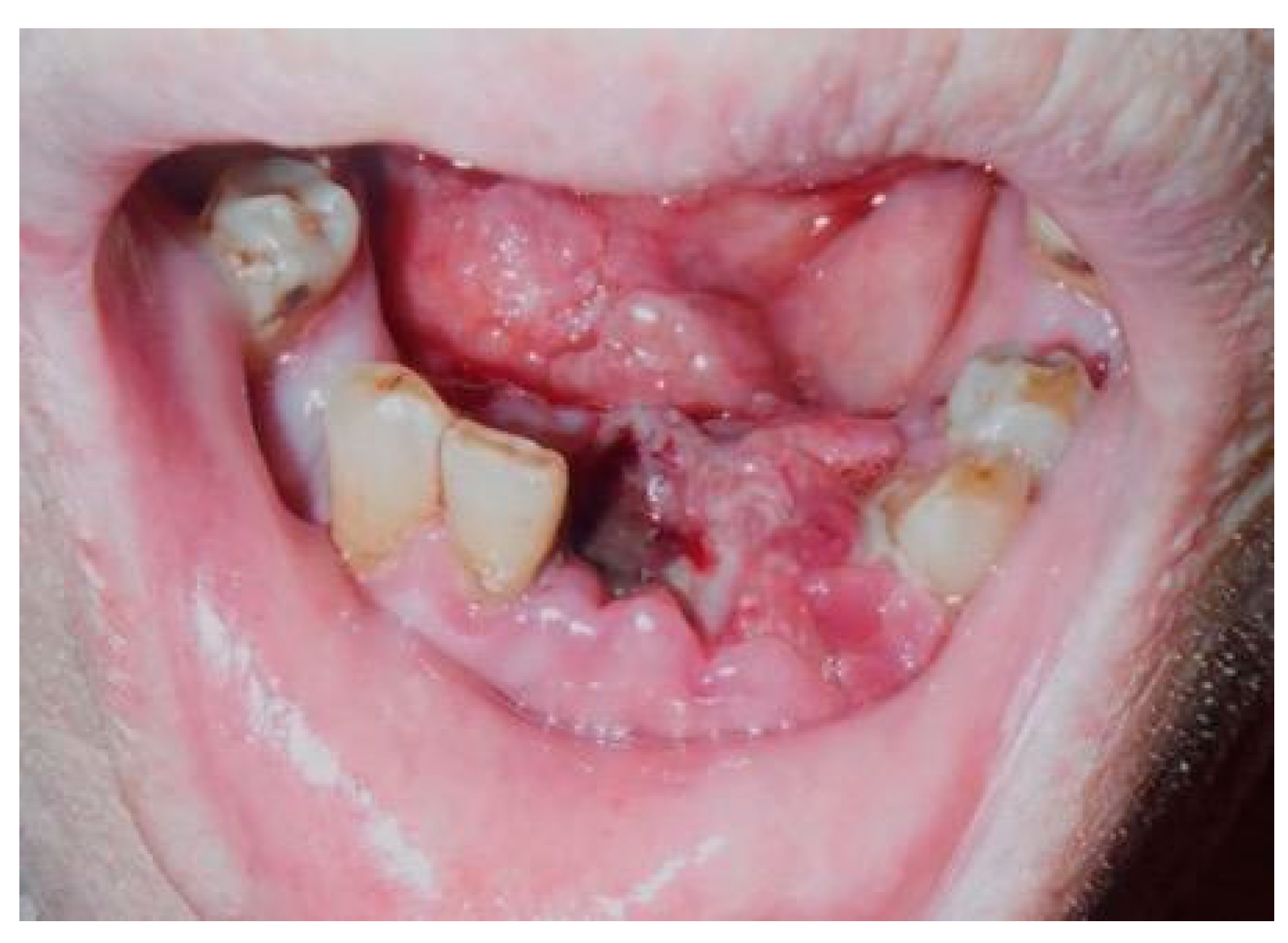 Dentistry 07 00102 g001 Dentistry 07 00102 g001