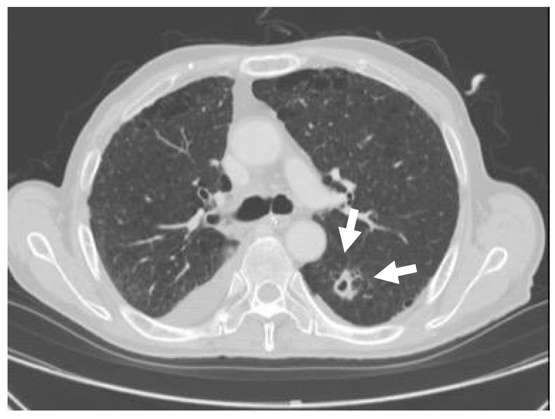Dentistry 07 00102 g003 Dentistry 07 00102 g003