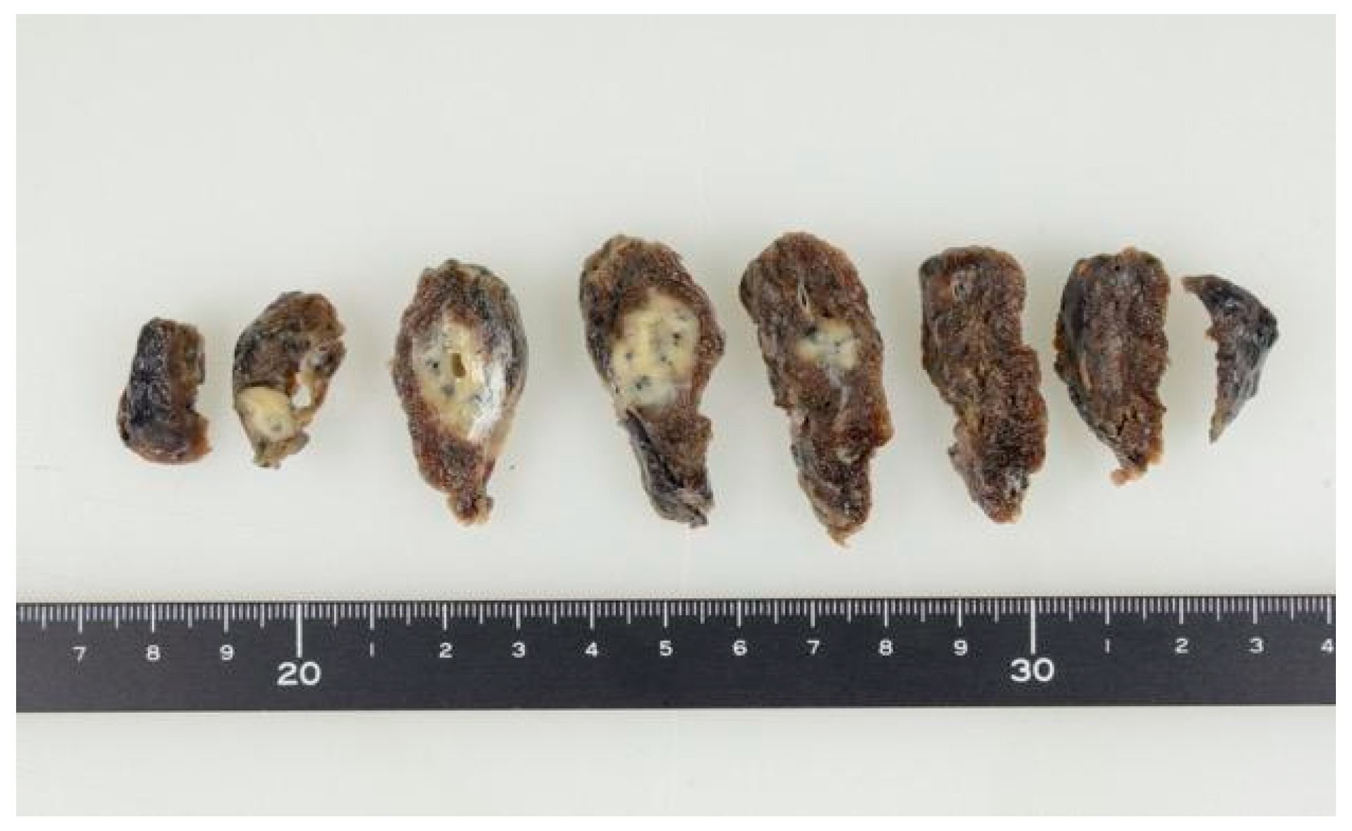 Dentistry 07 00102 g004 Dentistry 07 00102 g004