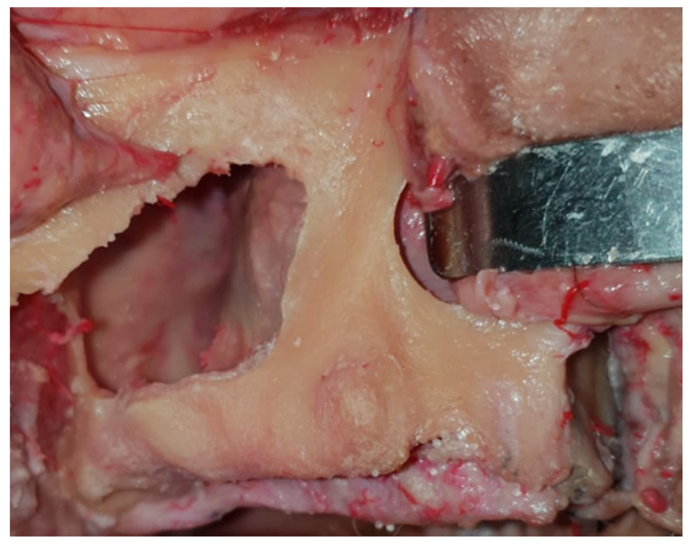 Dentistry 08 00014 g001