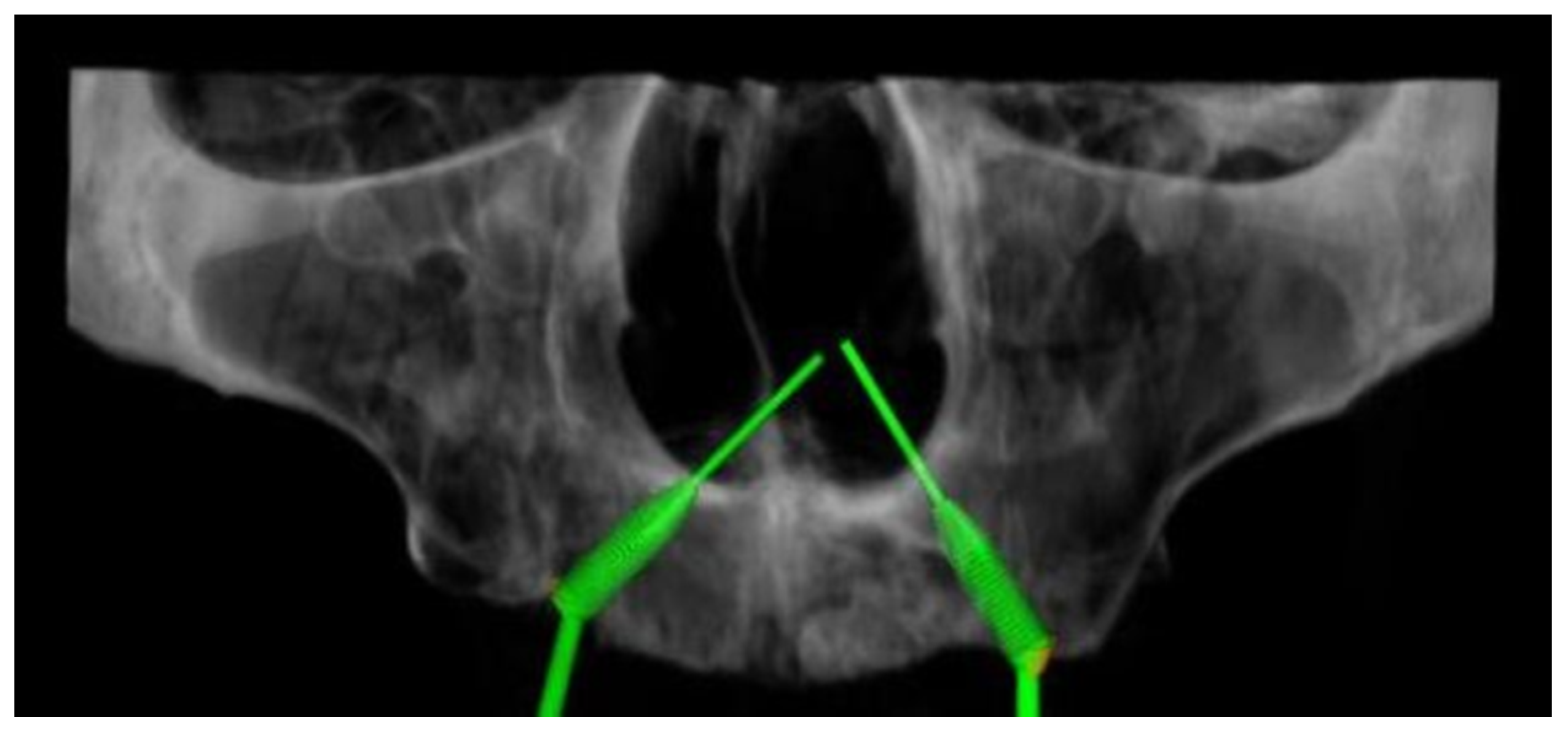 Dentistry 08 00014 g003