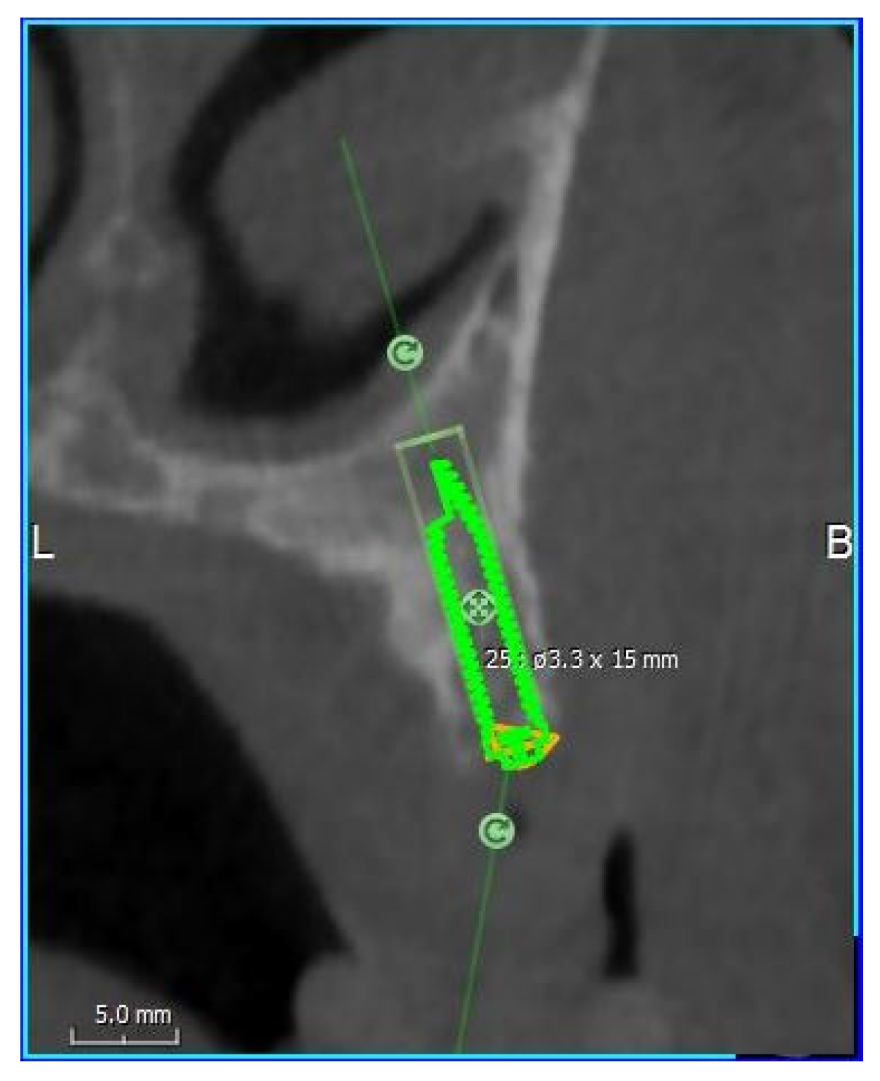 Dentistry 08 00014 g004