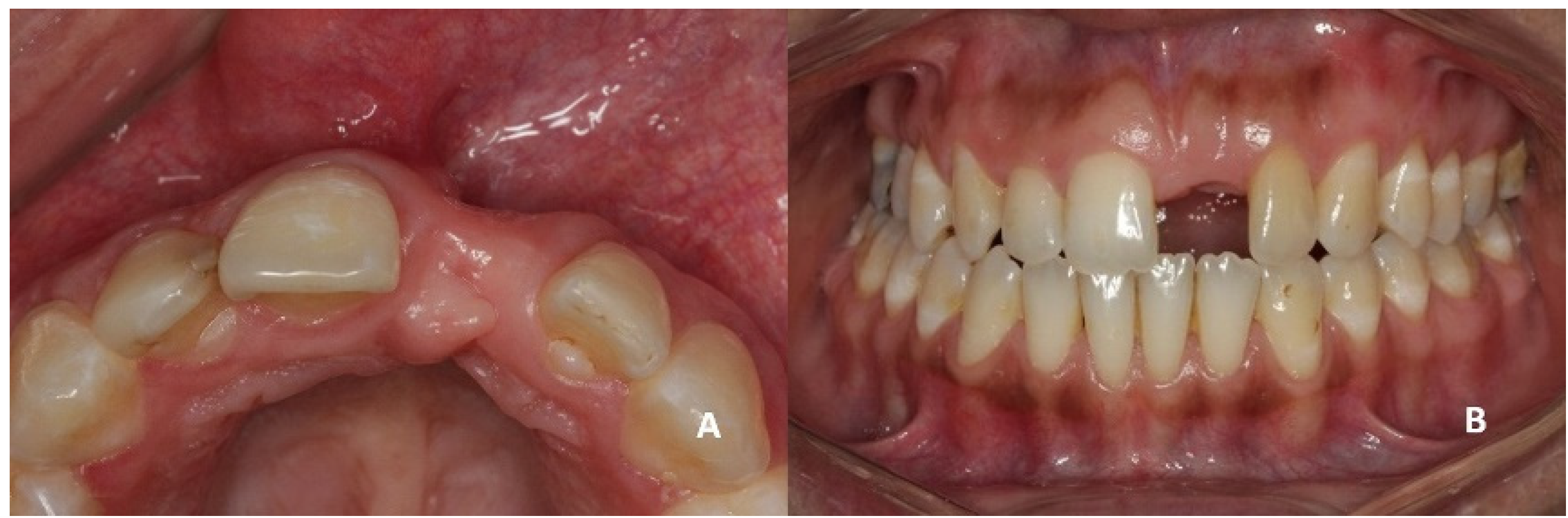Dentistry 08 00030 g001