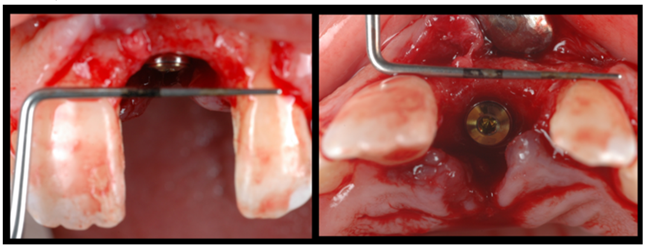 Dentistry 08 00030 g005