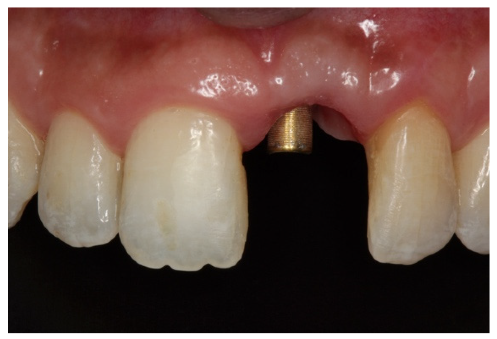 Dentistry 08 00030 g007