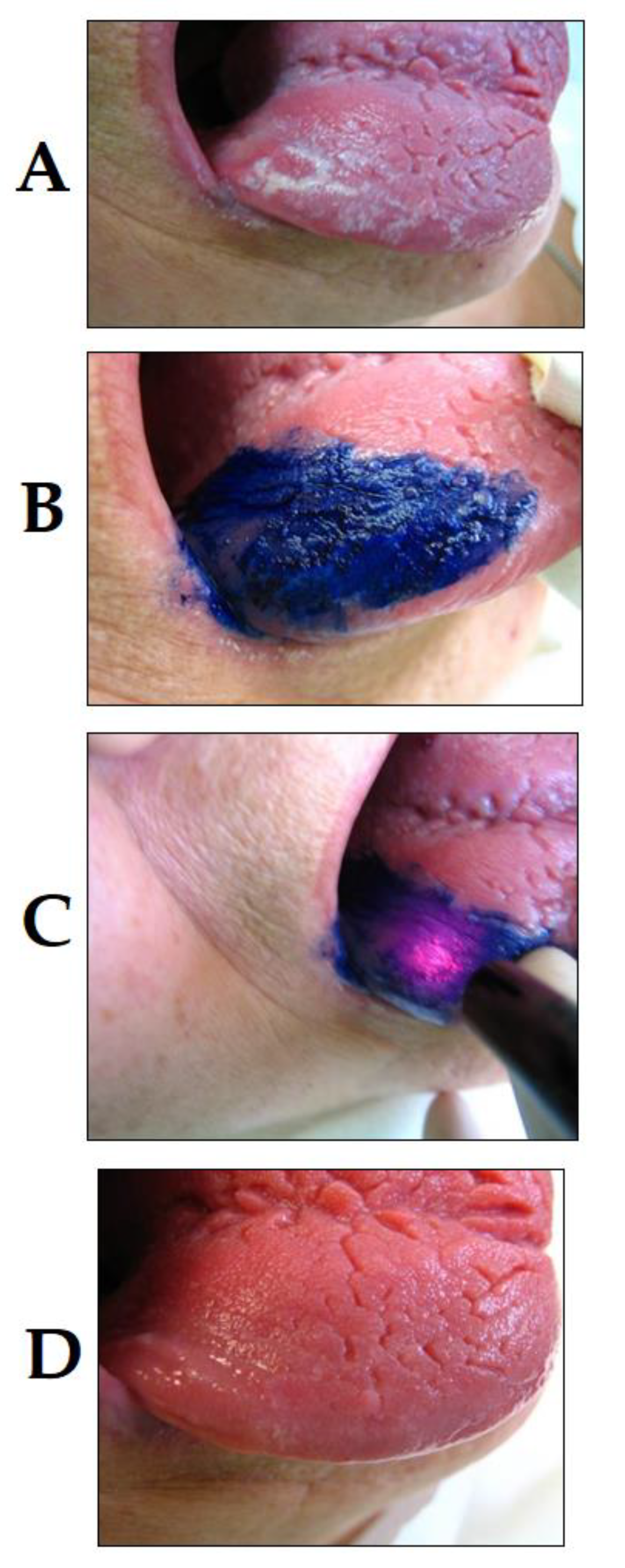 Dentistry 08 00043 g003