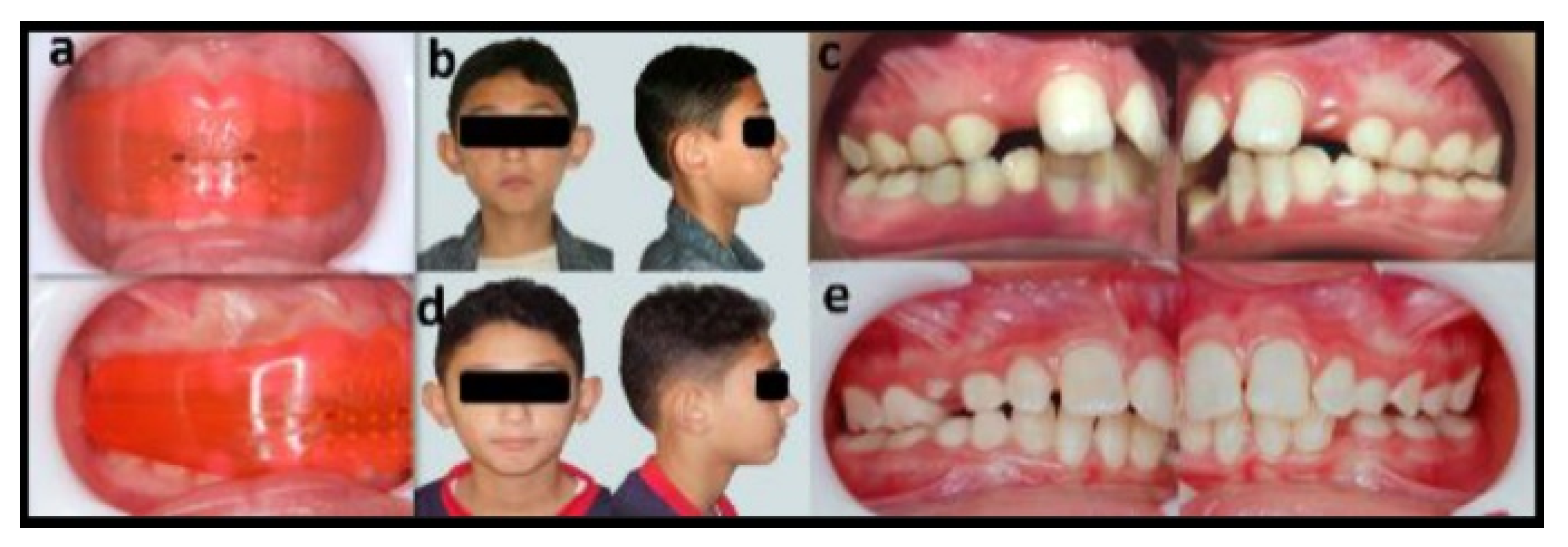 Dentistry 08 00044 g003