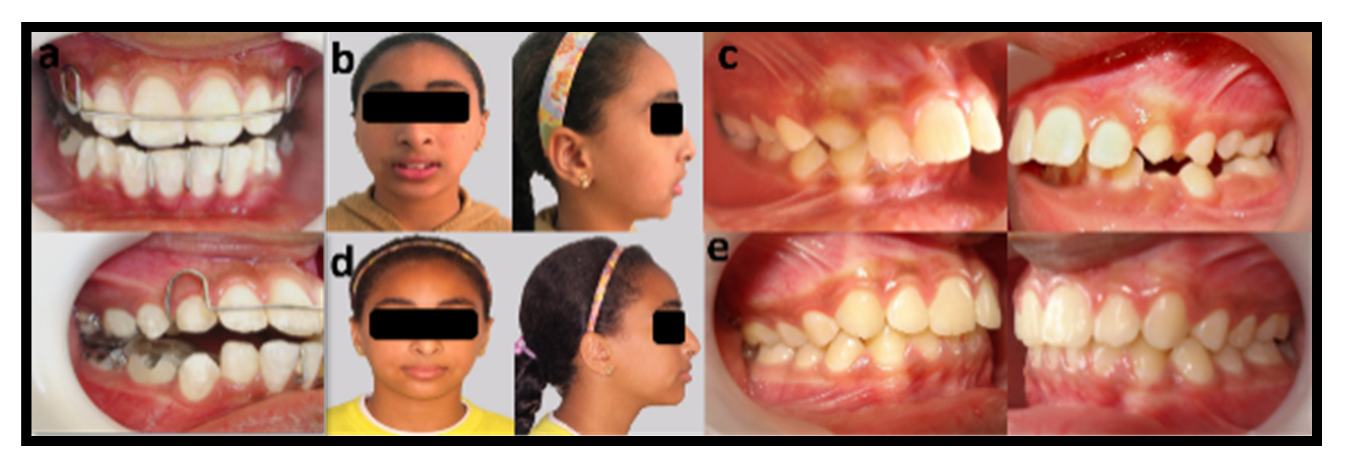 Dentistry 08 00044 g004