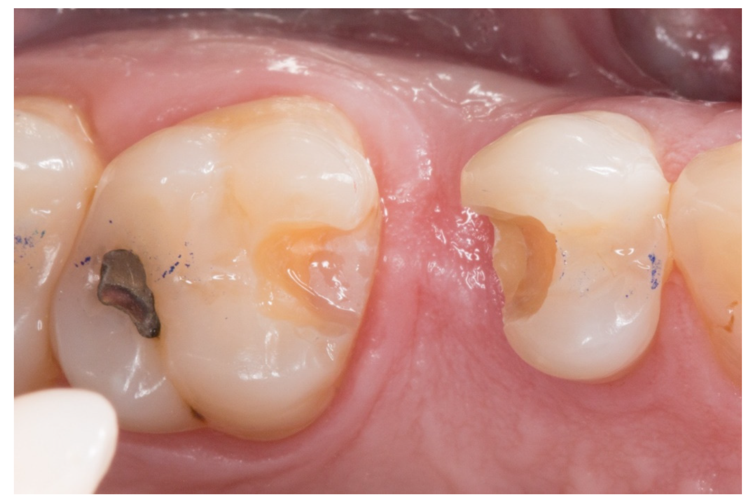 Dentistry 08 00048 g002