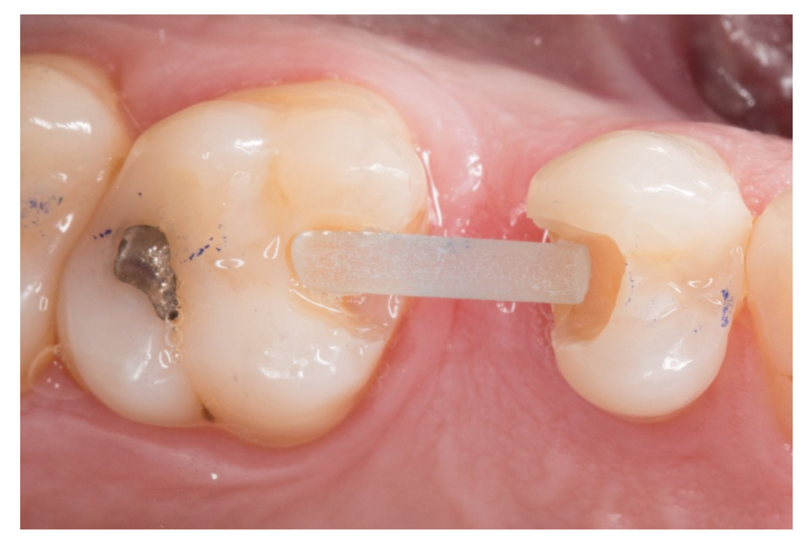 Dentistry 08 00048 g003