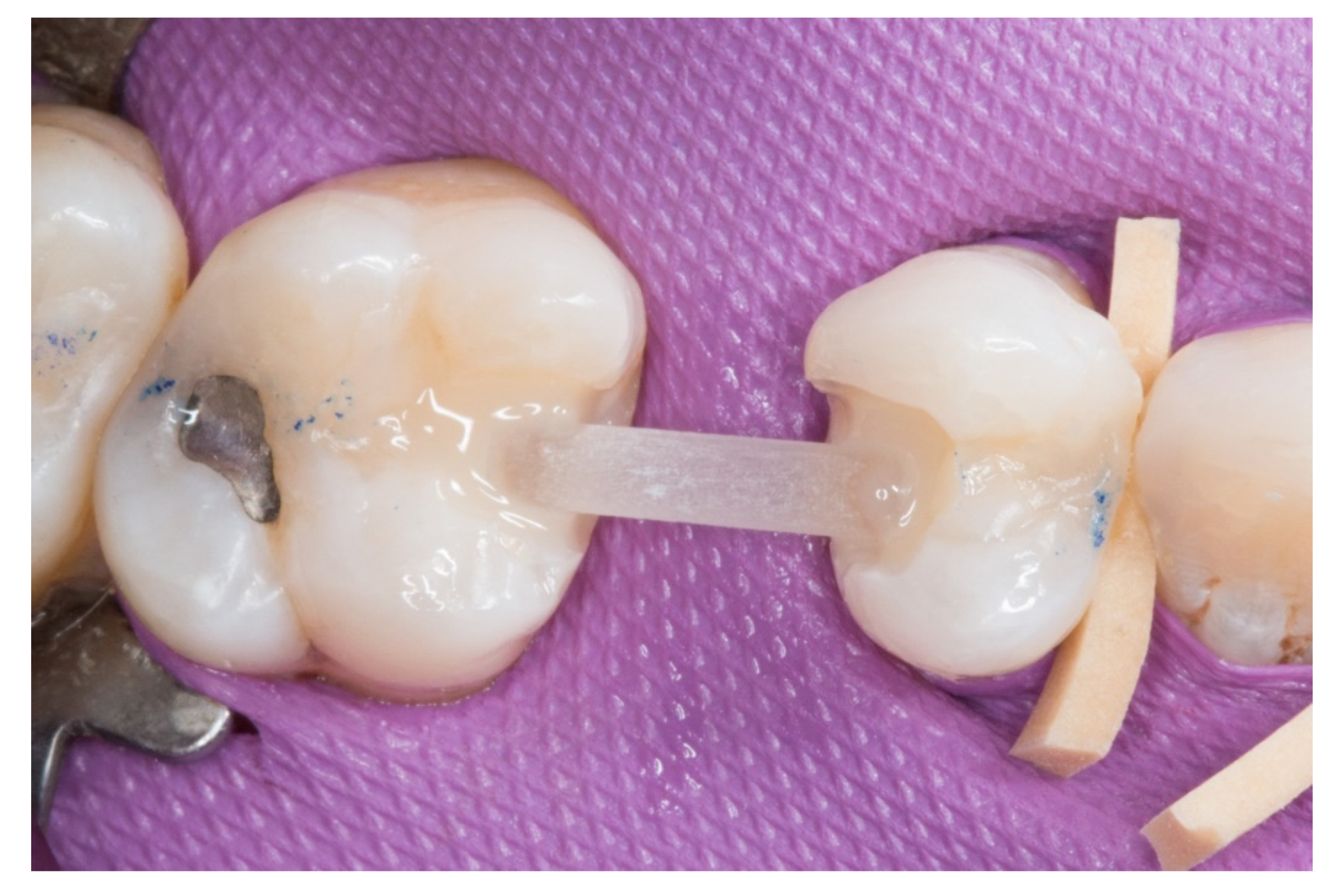 Dentistry 08 00048 g004