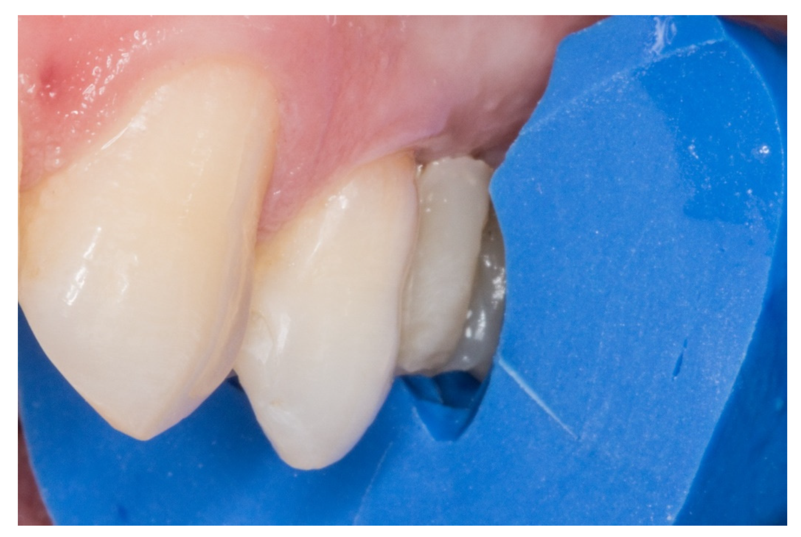 Dentistry 08 00048 g006