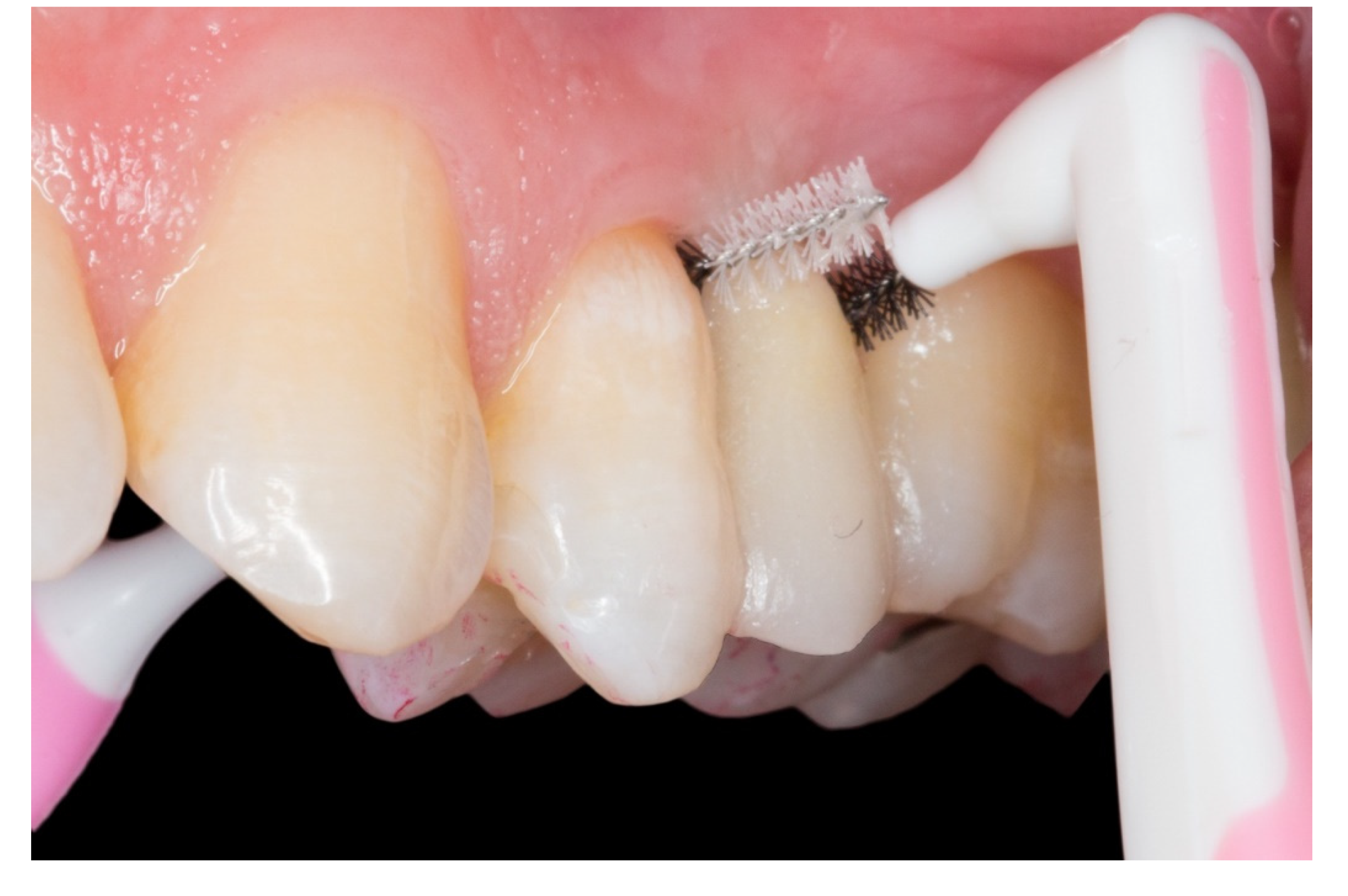 Dentistry 08 00048 g008