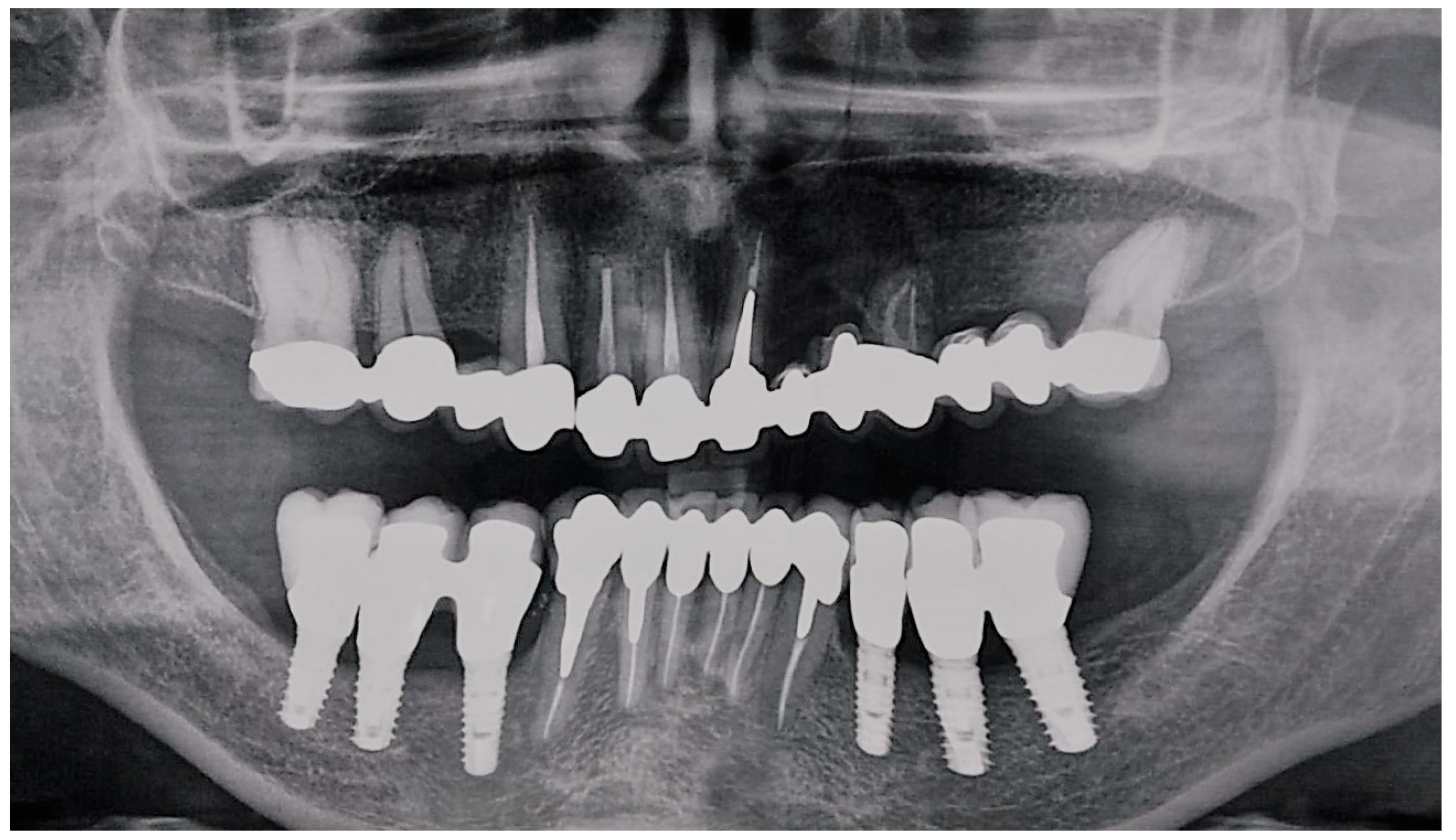 Dentistry 08 00049 g005