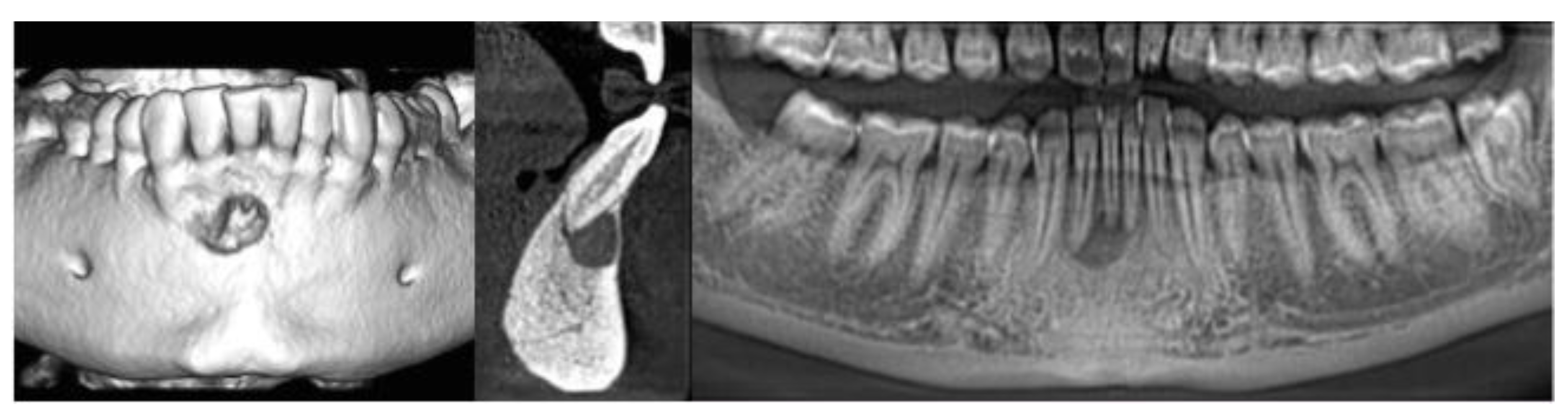 Dentistry 08 00051 g003