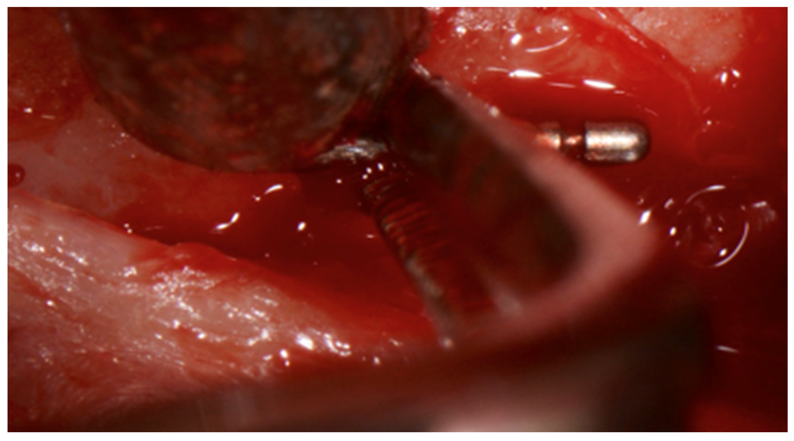 Dentistry 08 00055 g005