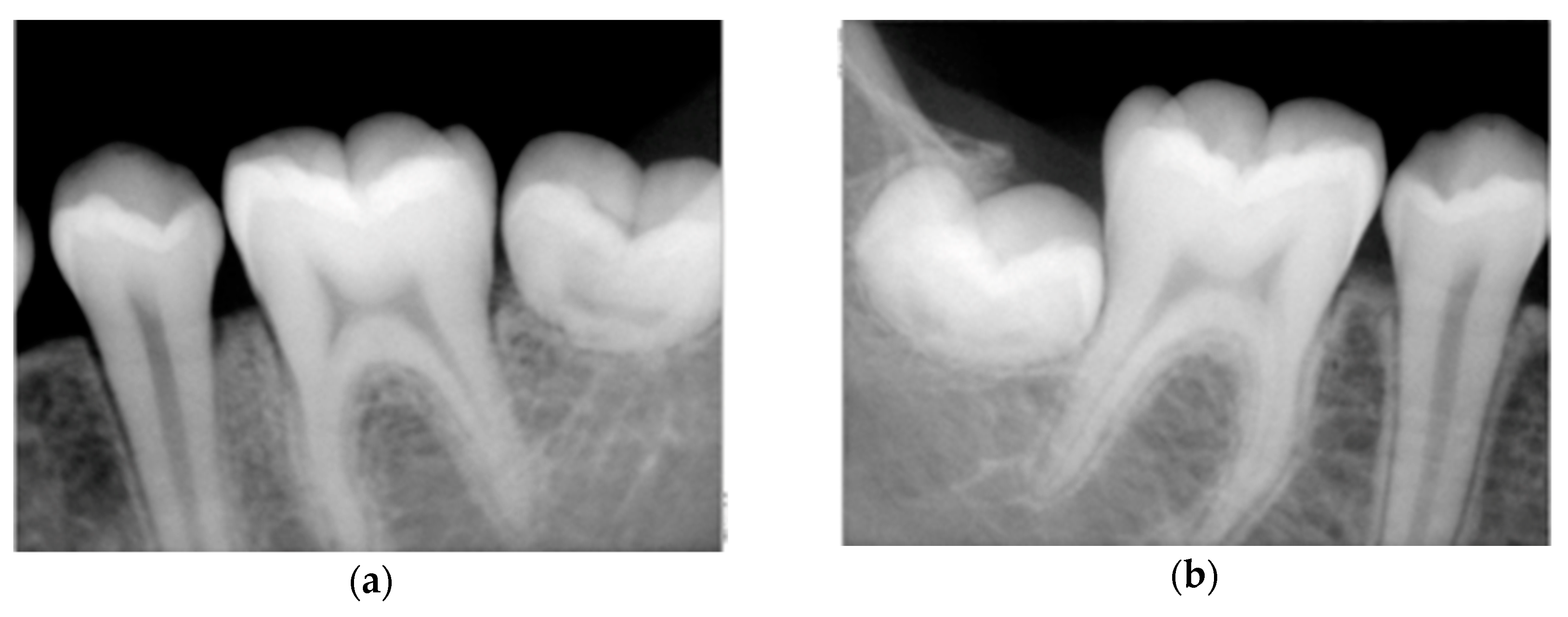 Dentistry 08 00059 g004