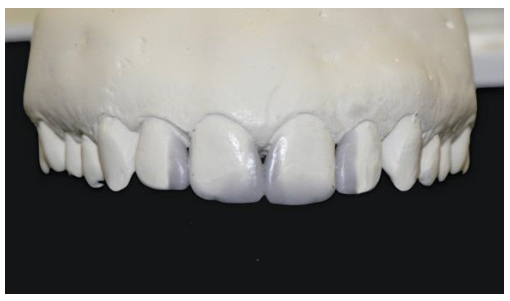 Dentistry 08 00060 g003