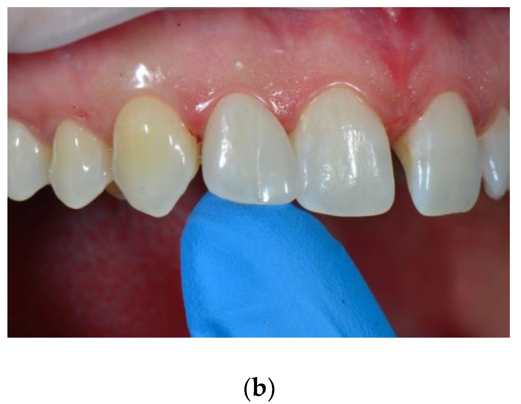 Dentistry 08 00060 g006b