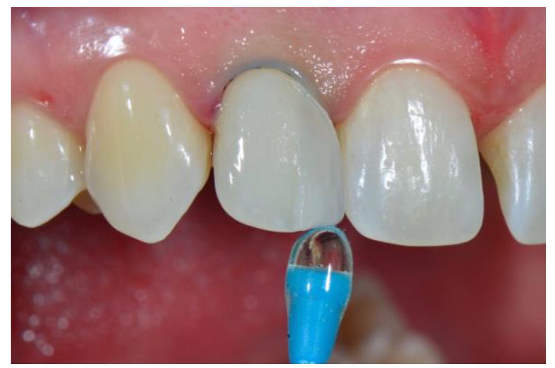 Dentistry 08 00060 g008