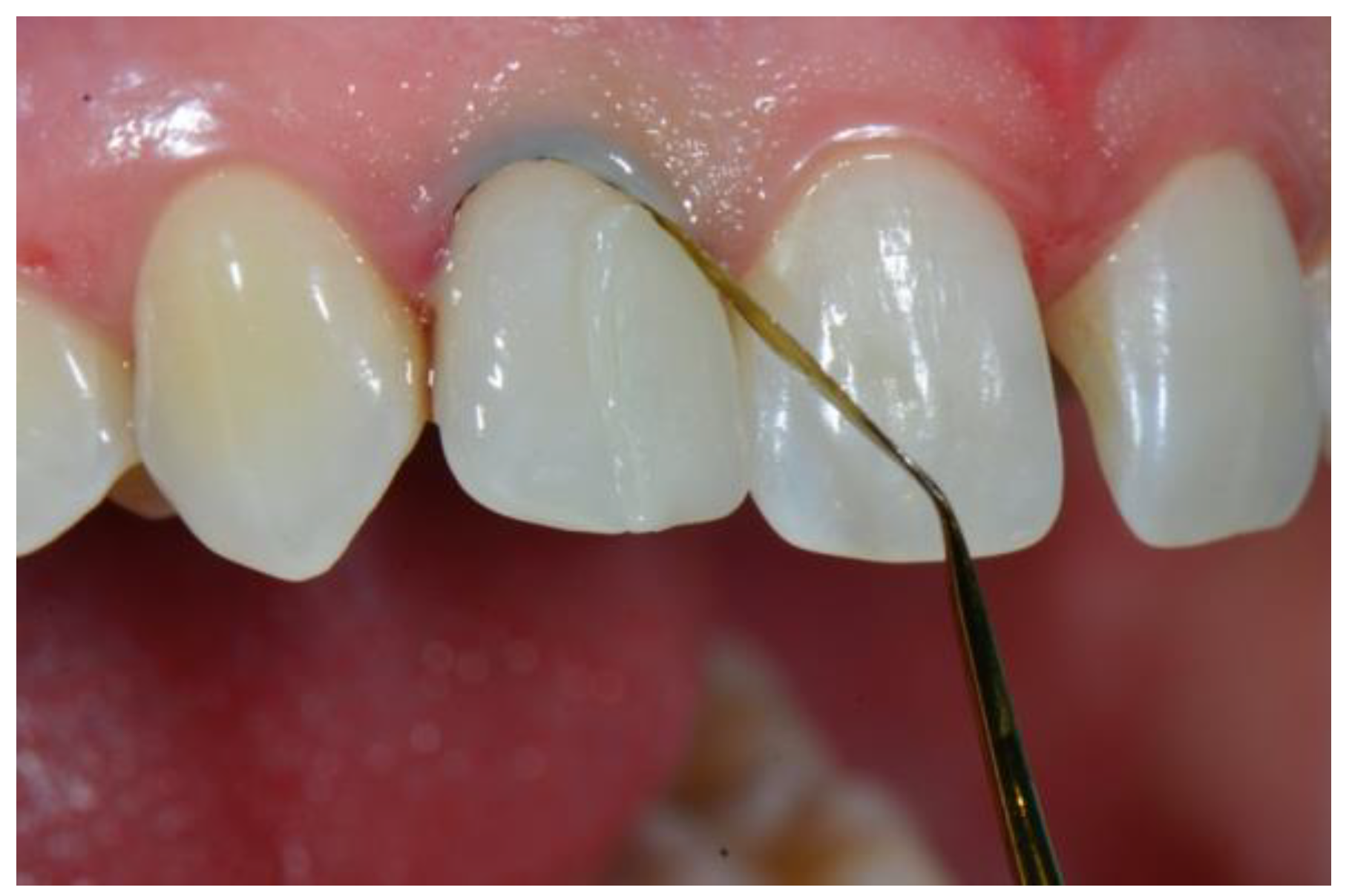 Dentistry 08 00060 g009