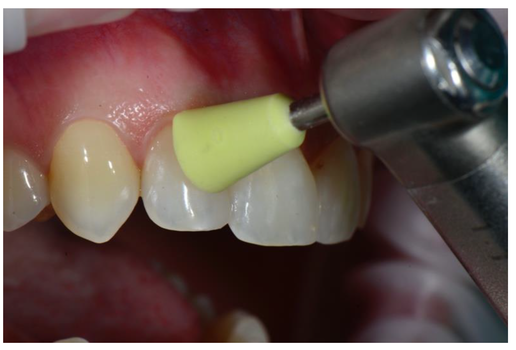 Dentistry 08 00060 g010