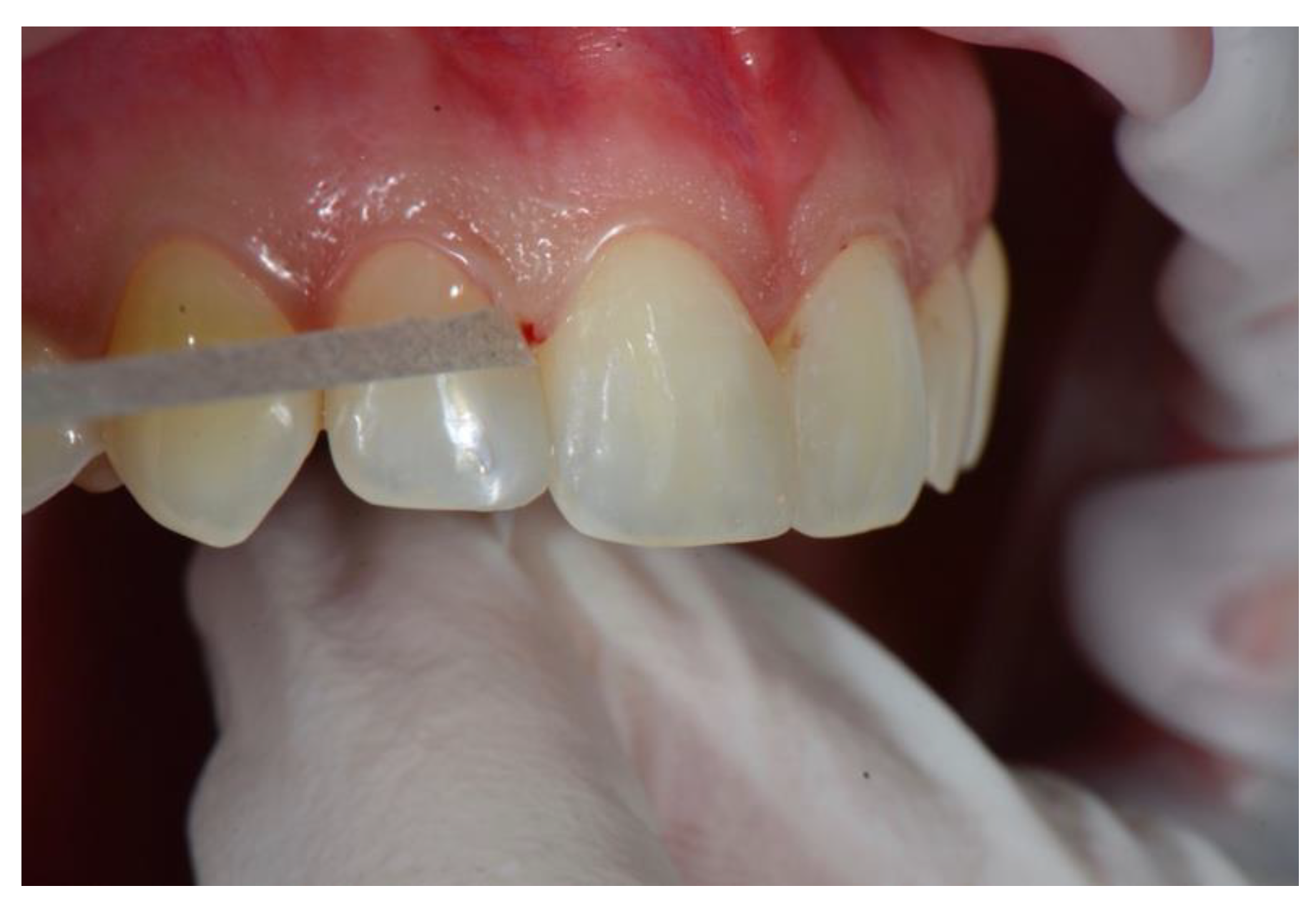 Dentistry 08 00060 g011