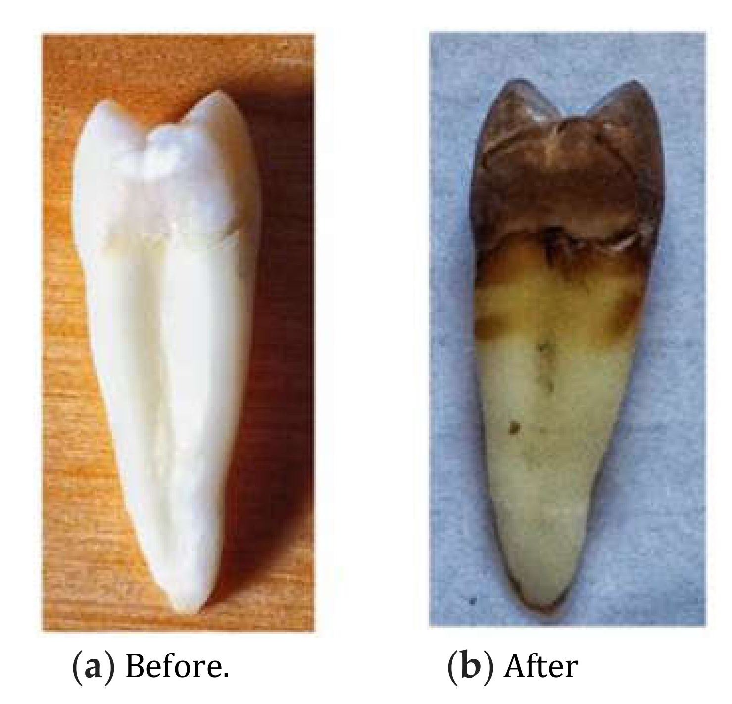 Dentistry 08 00062 g001