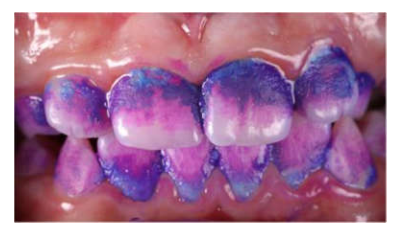 Dentistry 08 00062 g002