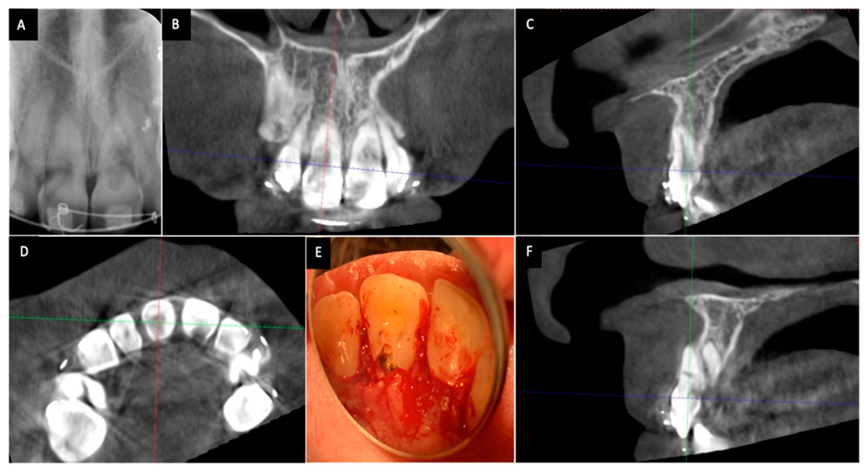 Dentistry 08 00064 g001