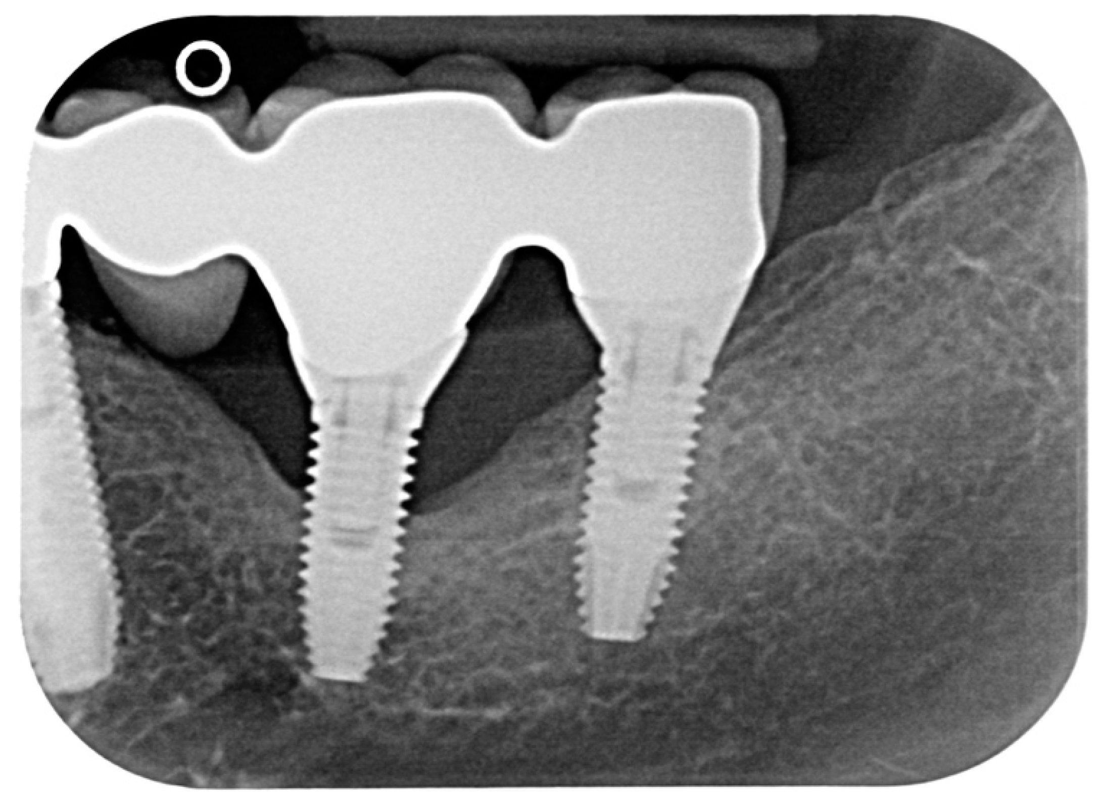 Dentistry 08 00070 g001 Dentistry 08 00070 g001