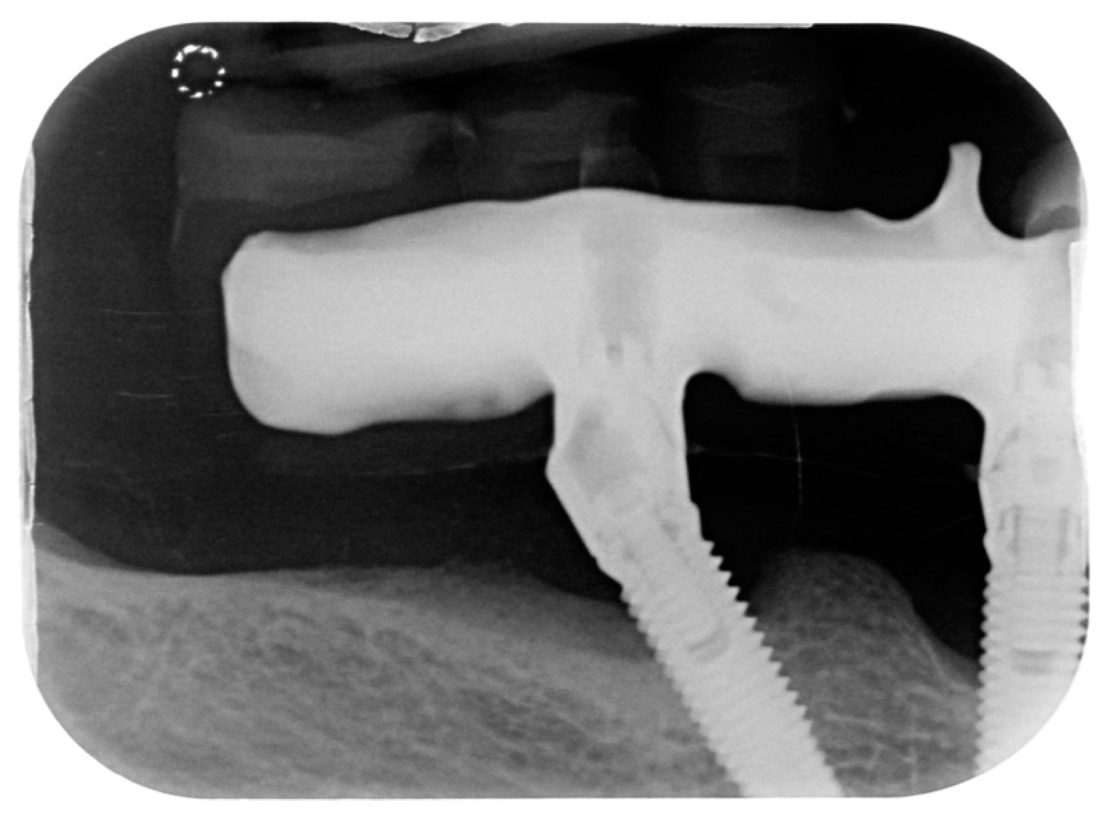 Dentistry 08 00070 g002 Dentistry 08 00070 g002