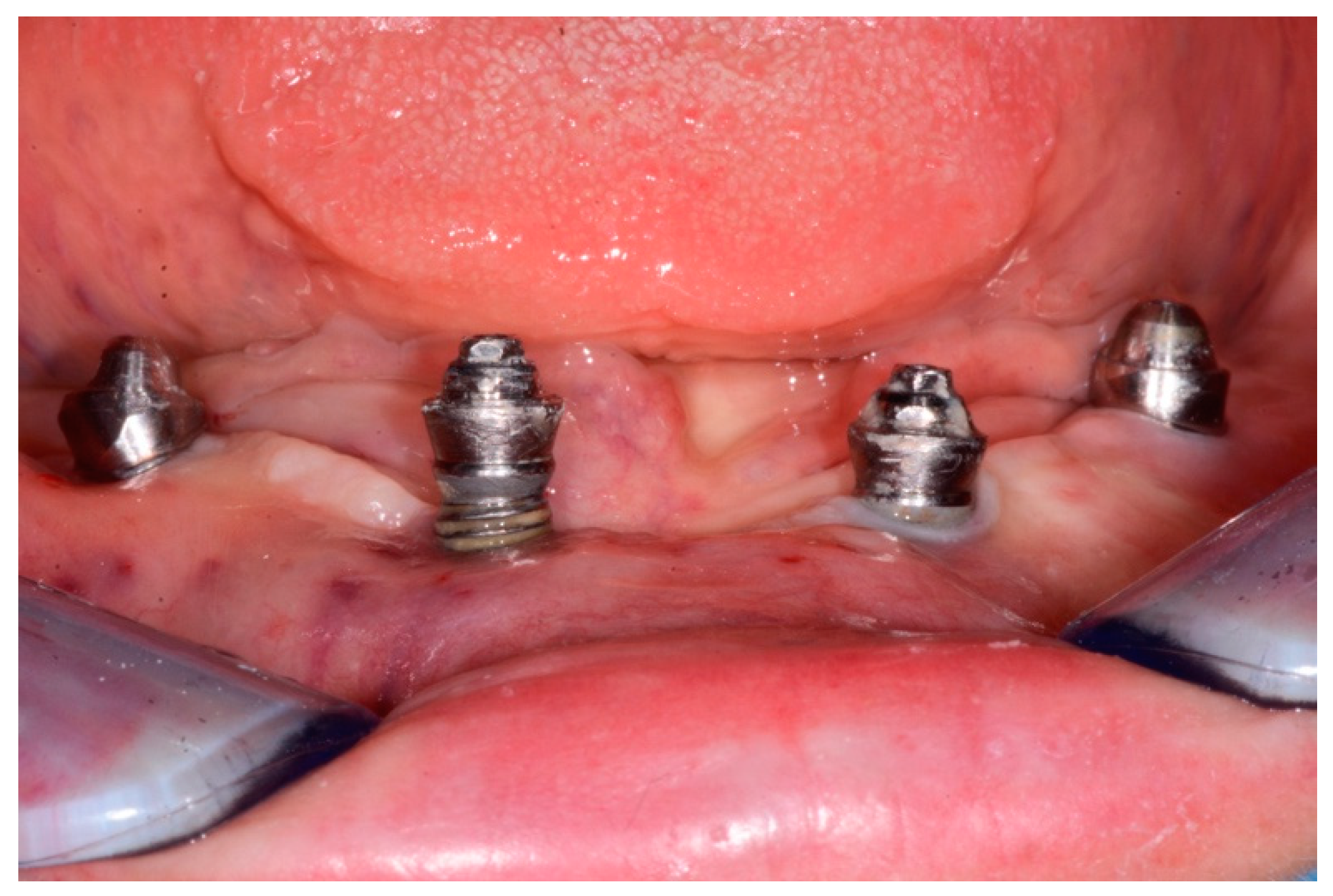 Dentistry 08 00070 g003 Dentistry 08 00070 g003