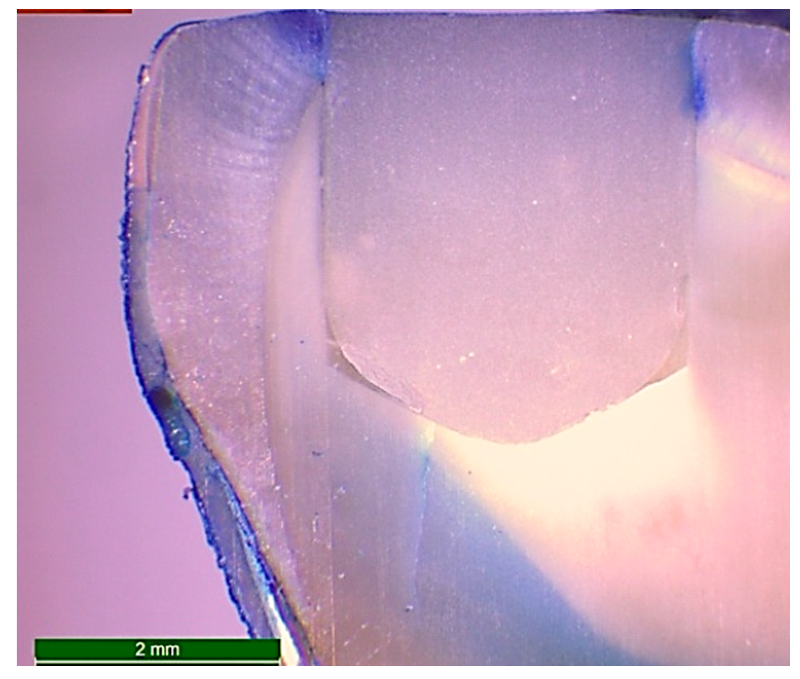 Dentistry 08 00076 g003