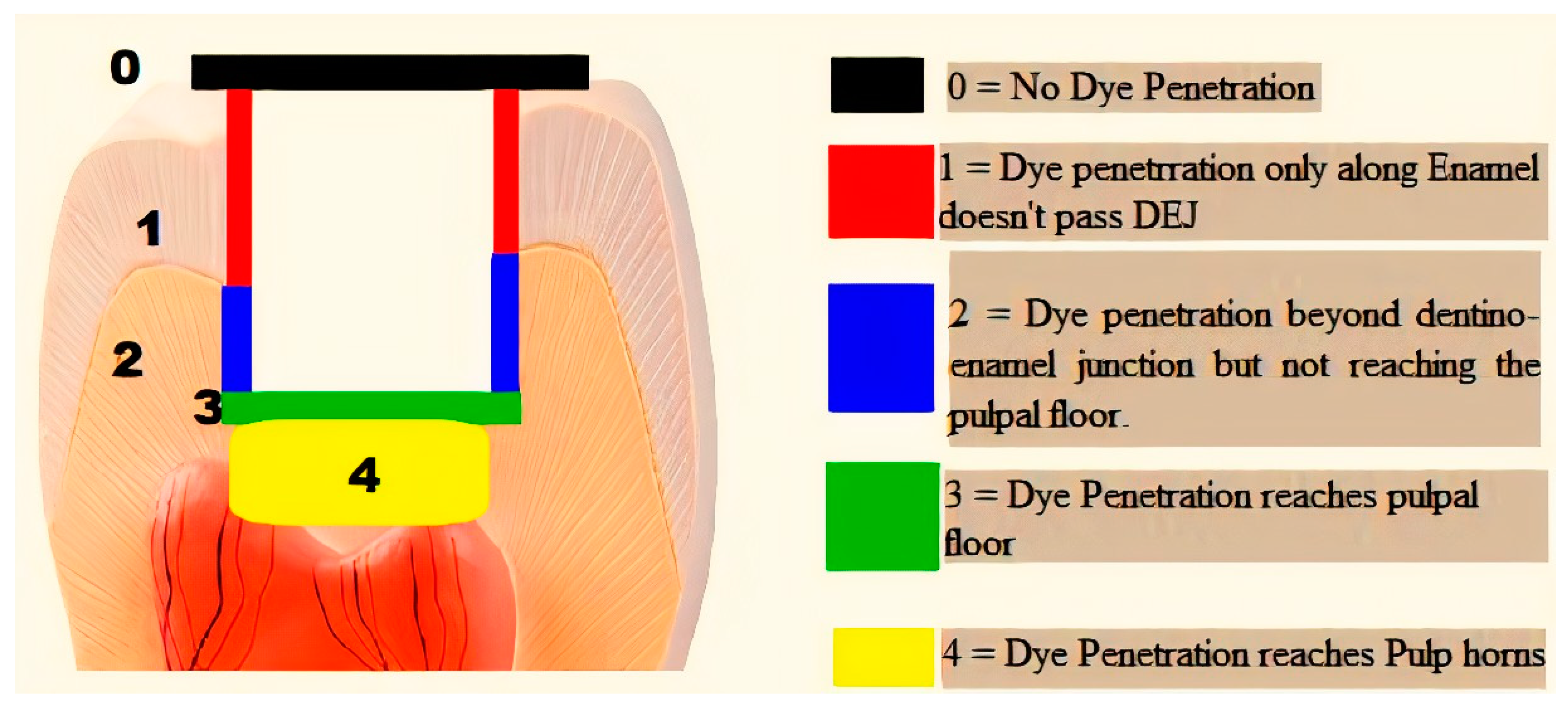Dentistry 08 00076 g004