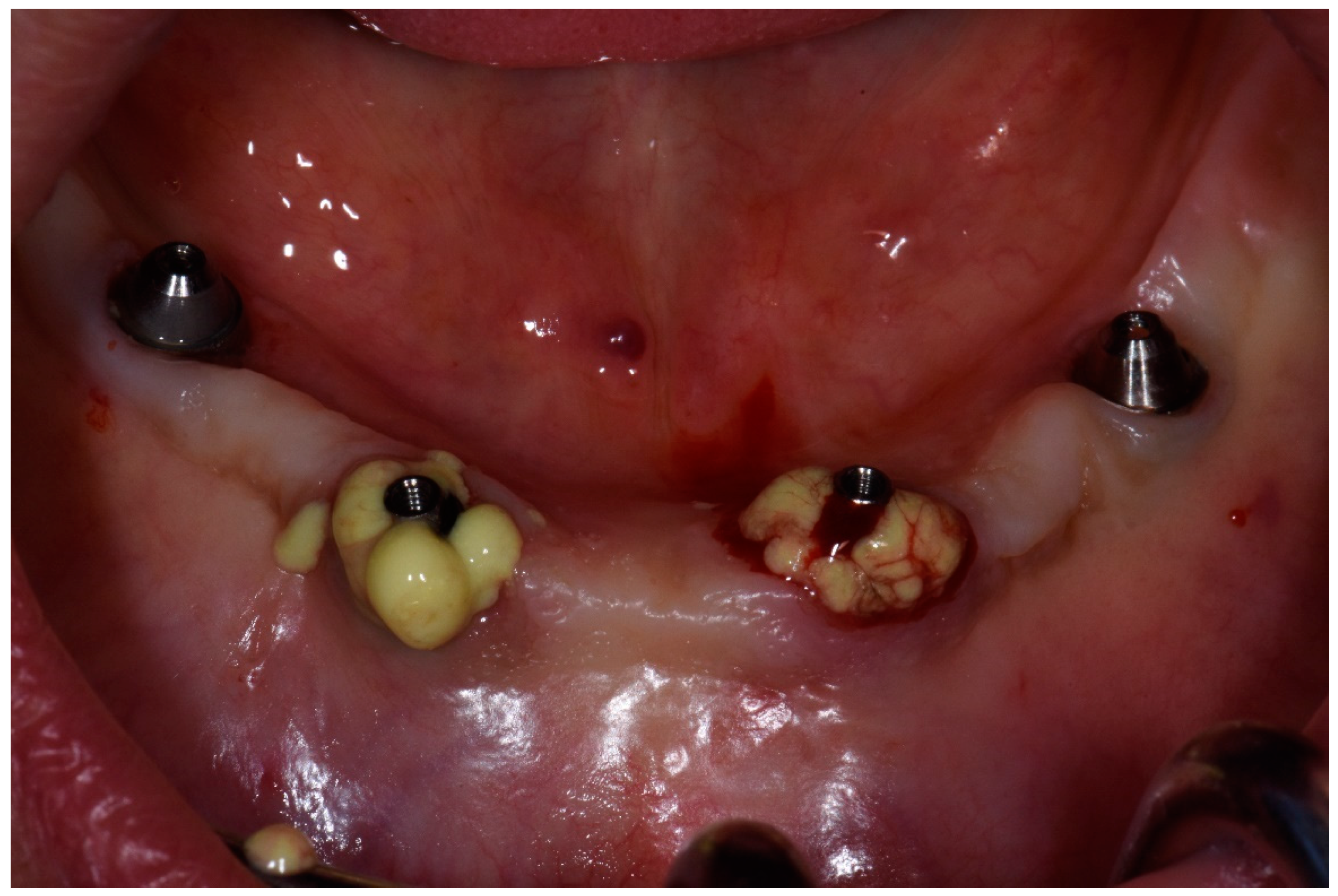 Dentistry 08 00078 g003