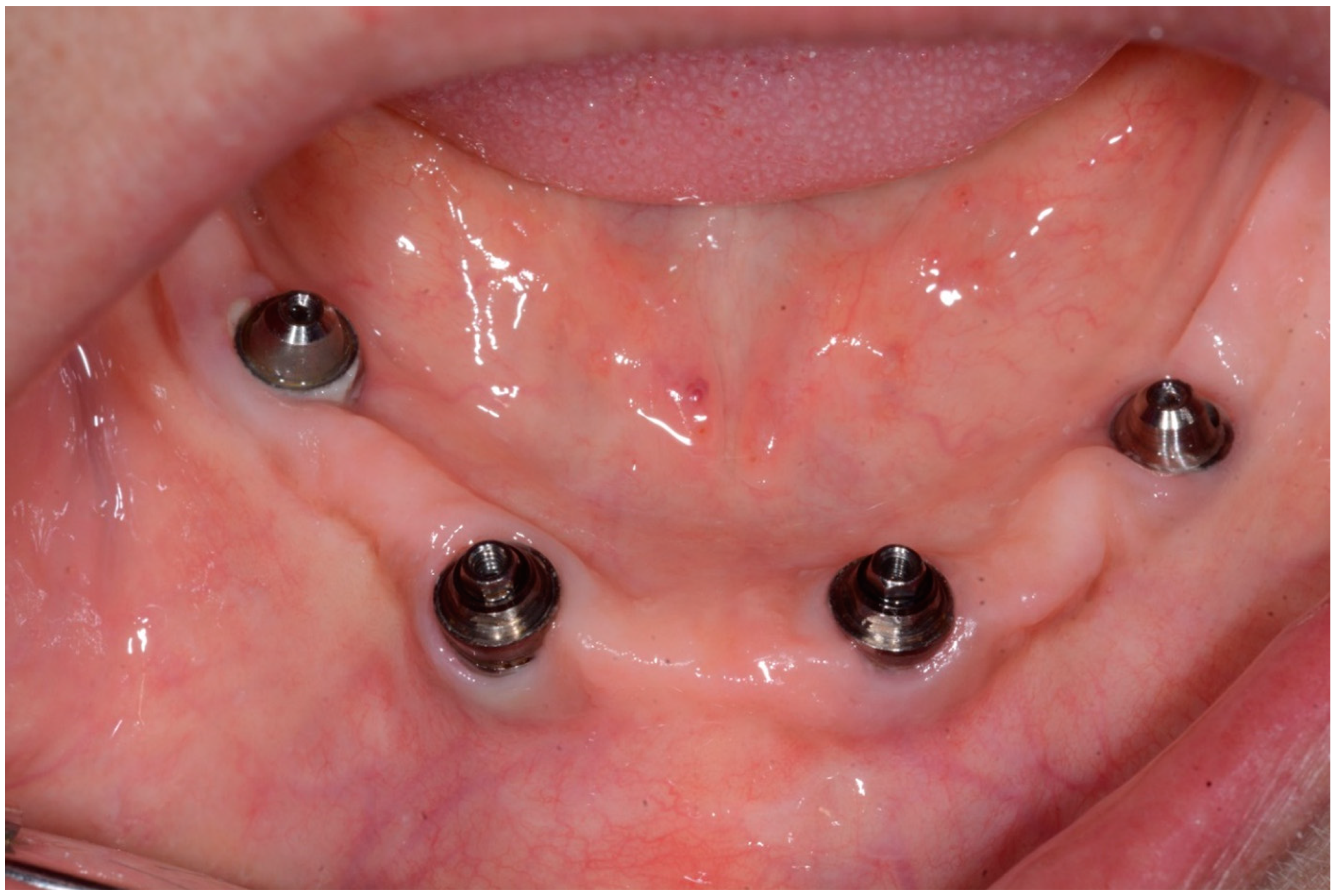 Dentistry 08 00078 g004