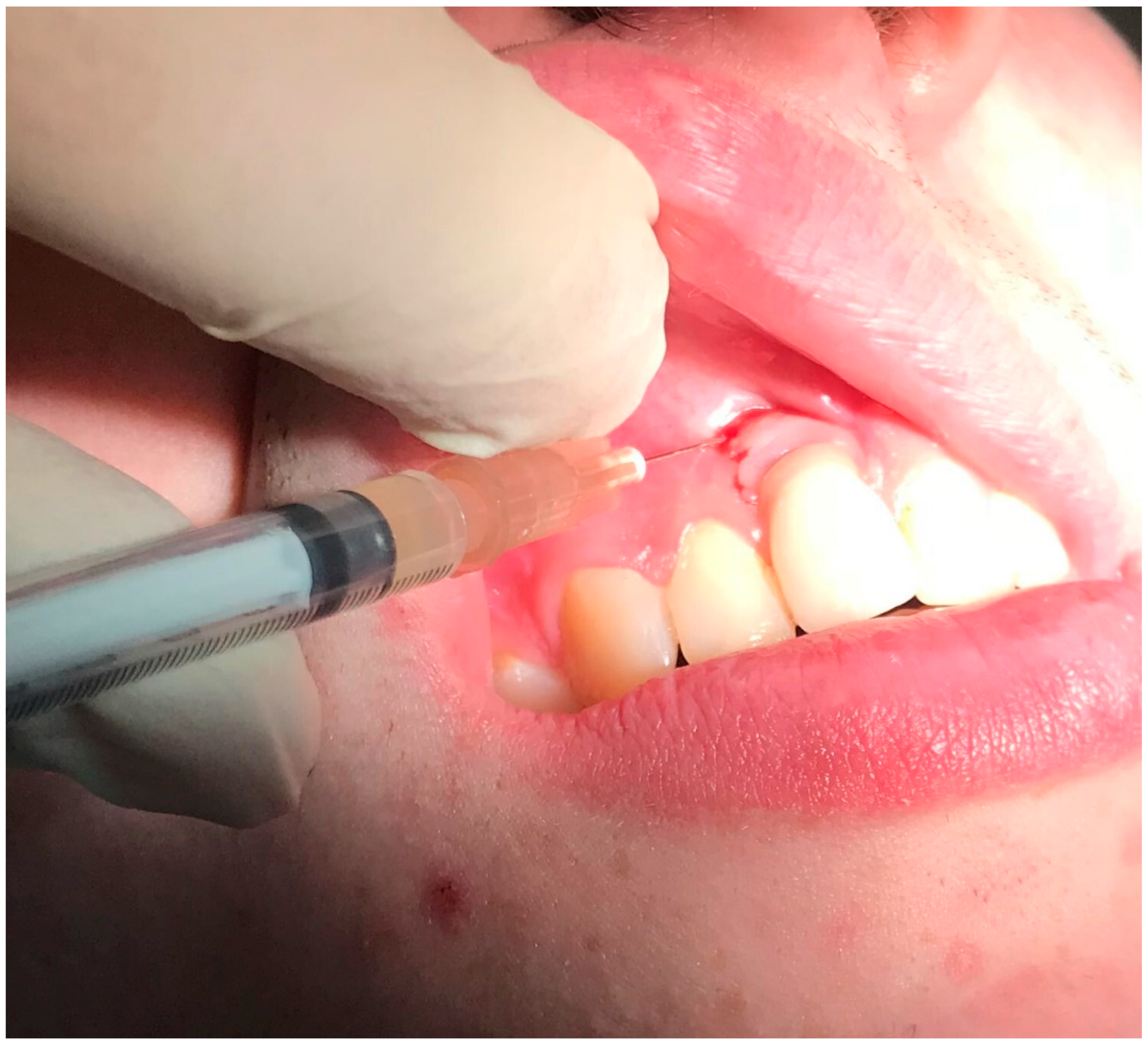 Dentistry 08 00078 g007