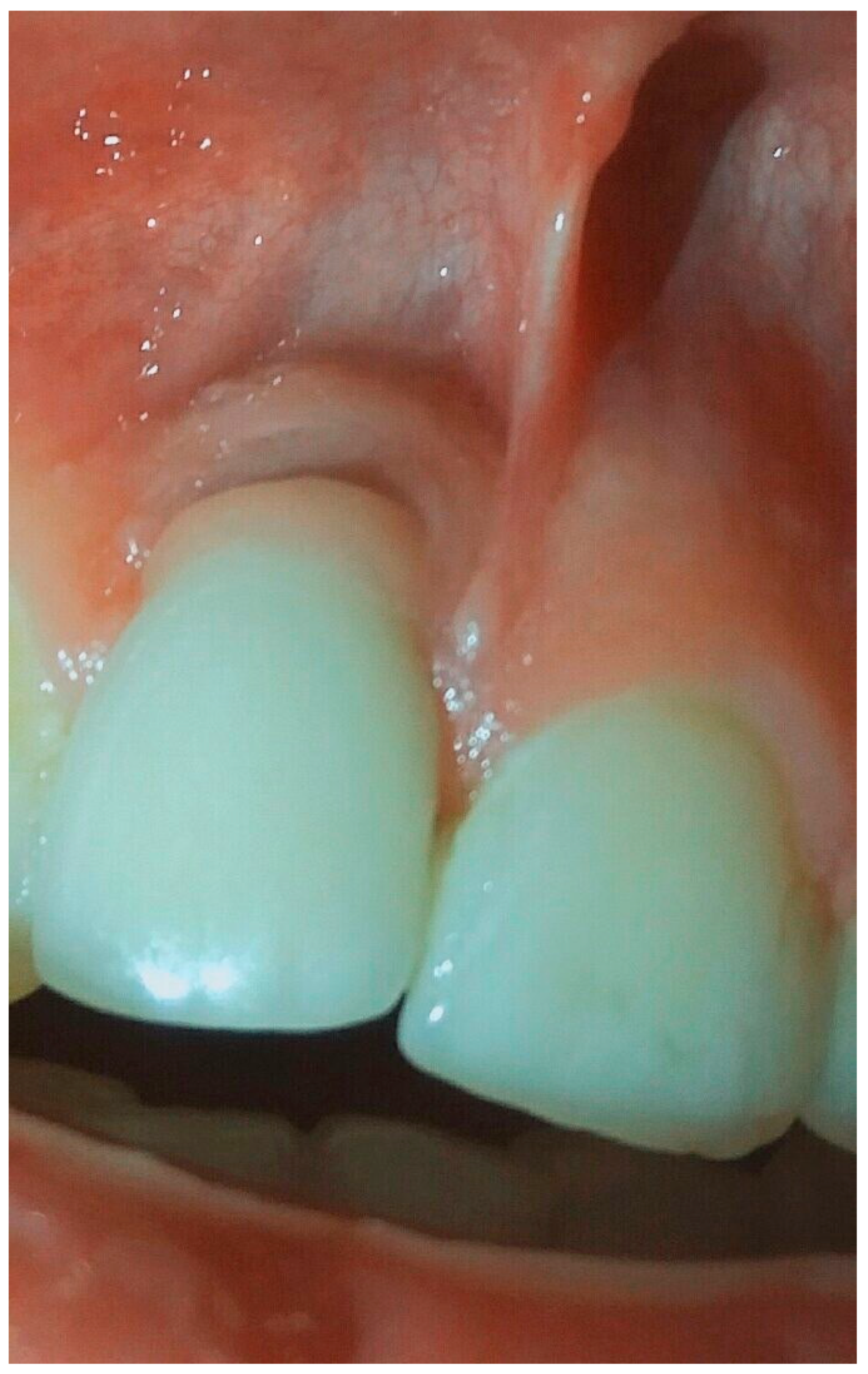 Dentistry 08 00078 g008