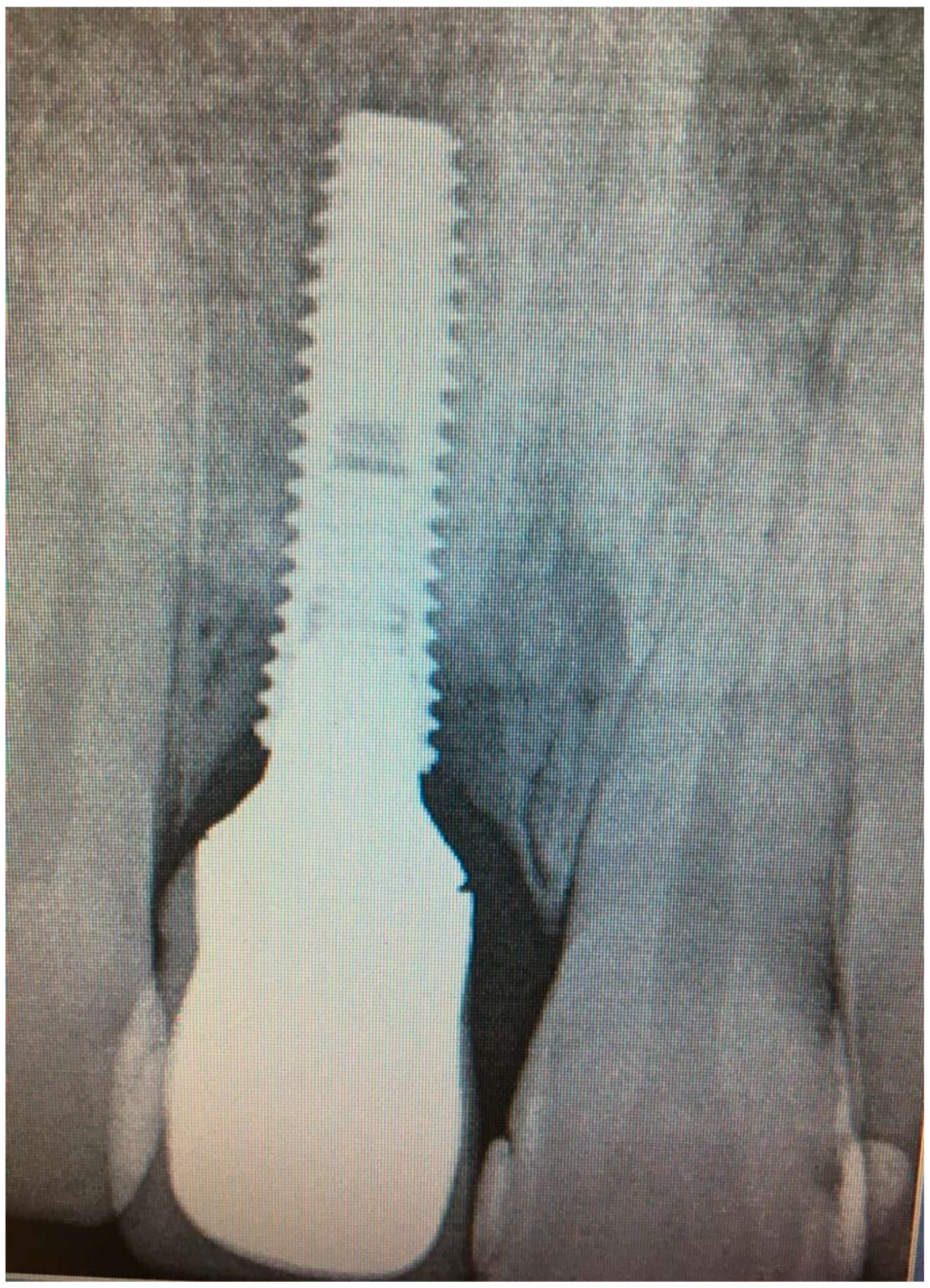 Dentistry 08 00078 g009