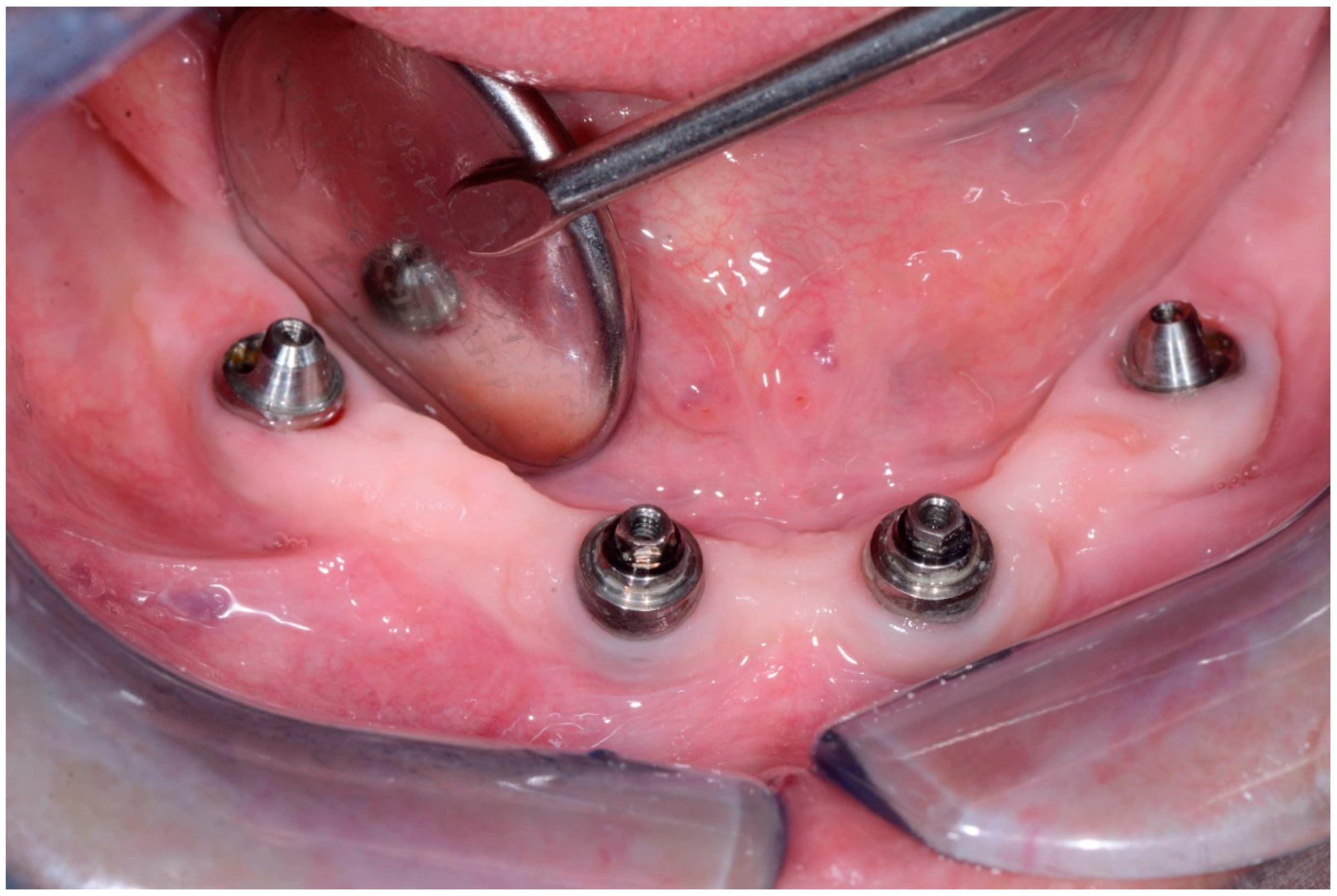 Dentistry 08 00078 g012