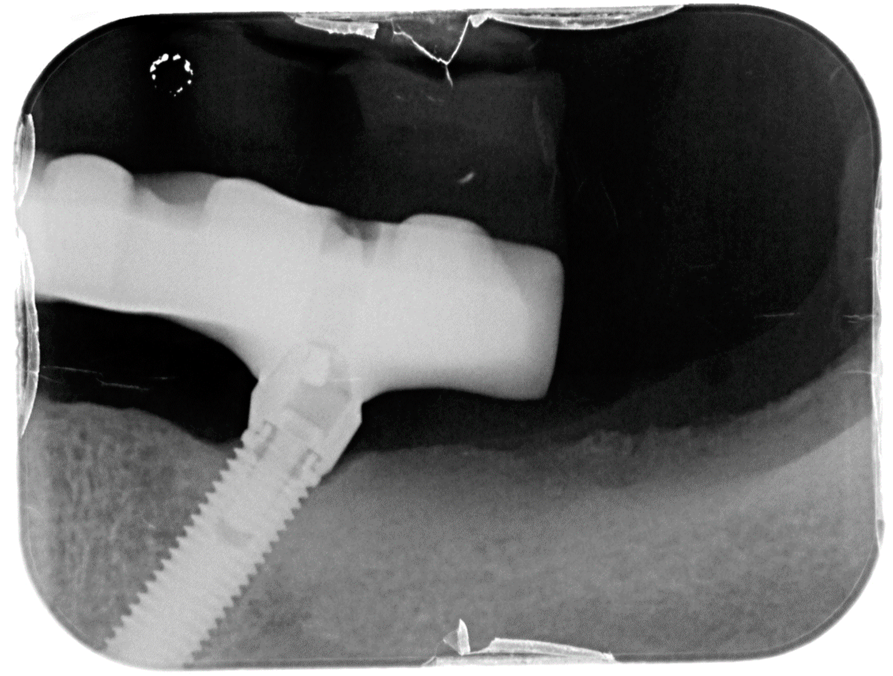 Dentistry 08 00078 g013