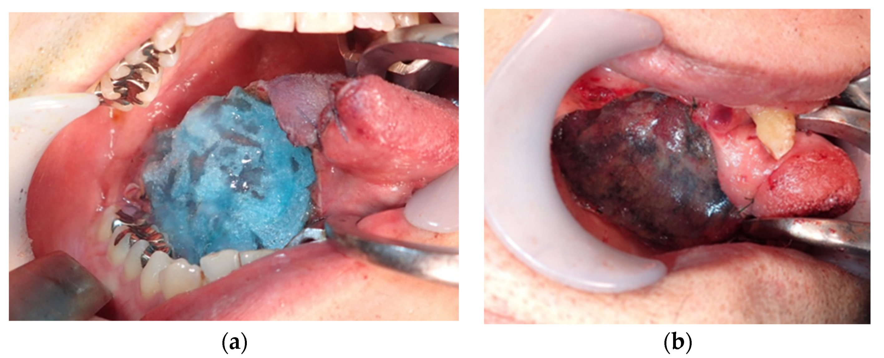 Dentistry 08 00085 g001 Dentistry 08 00085 g001