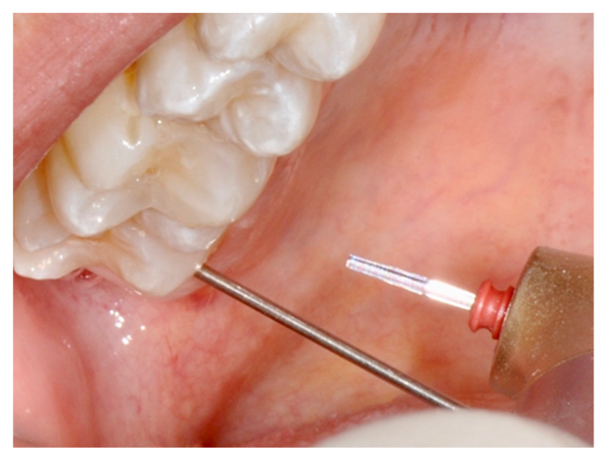 Dentistry 08 00128 g002 Dentistry 08 00128 g002