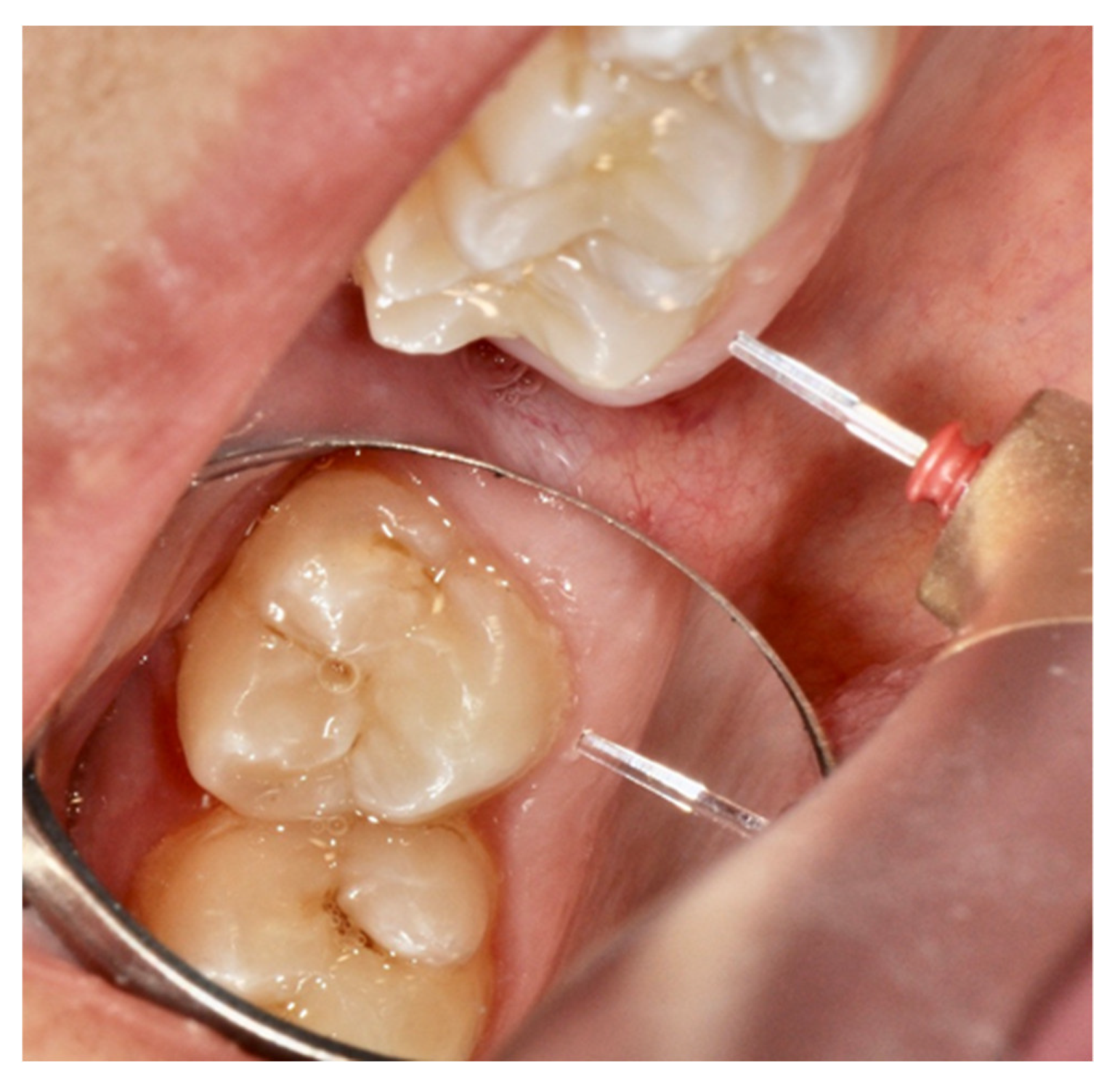 Dentistry 08 00128 g003 Dentistry 08 00128 g003