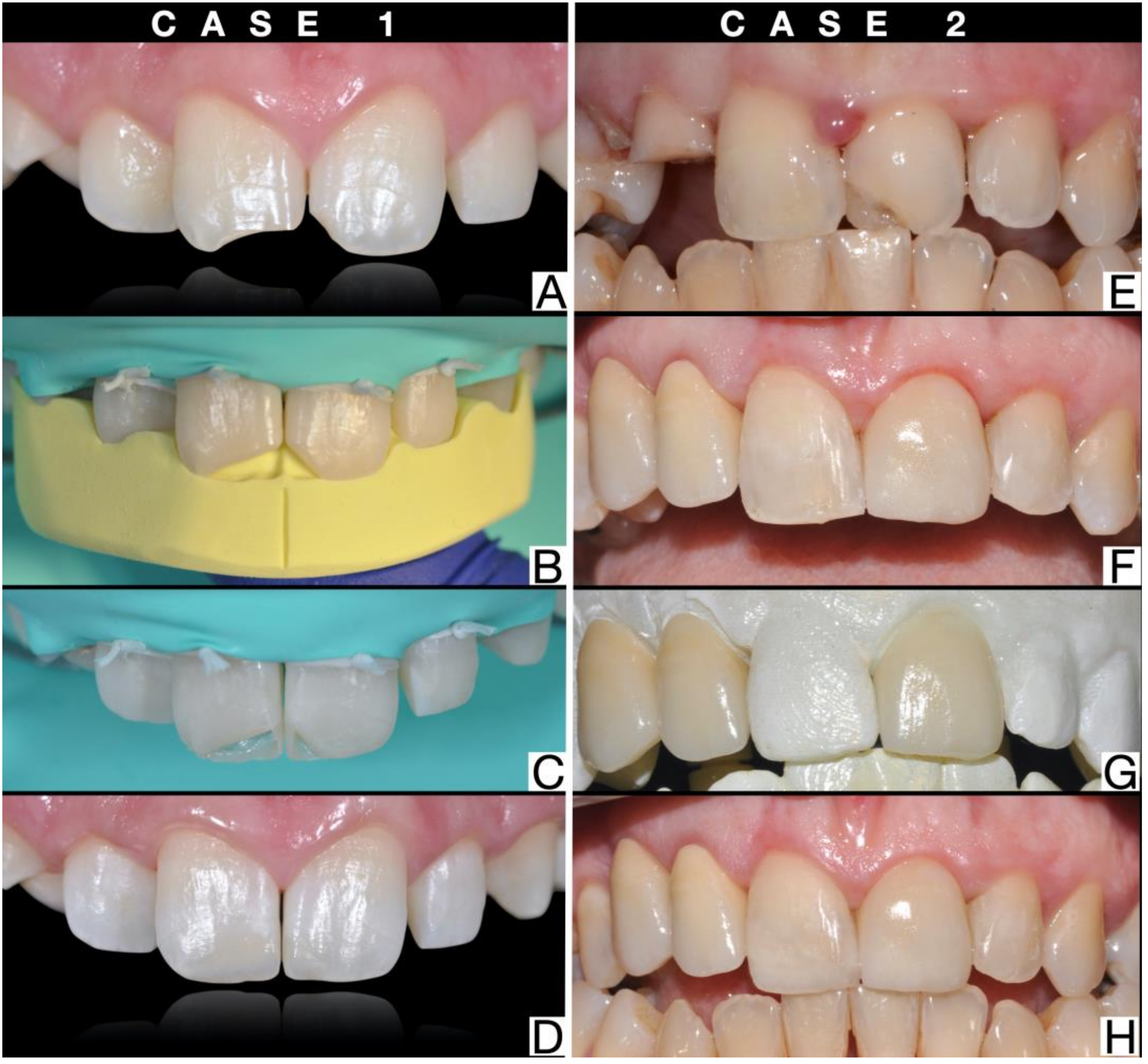 Dentistry 09 00013 g001 Dentistry 09 00013 g001