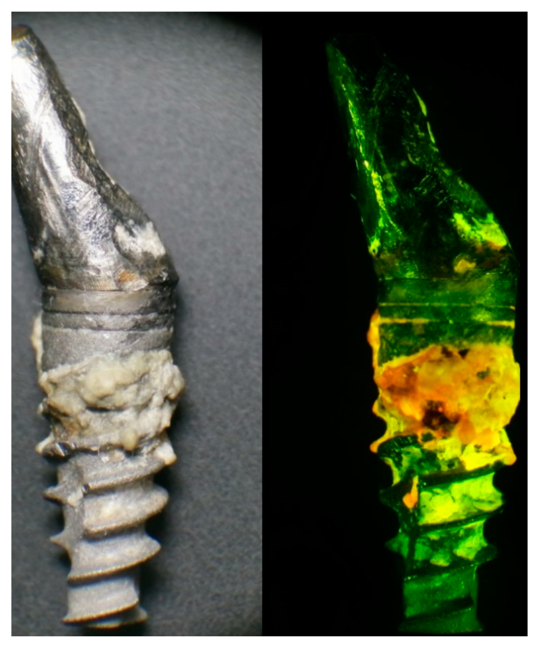 Dentistry 09 00024 g001